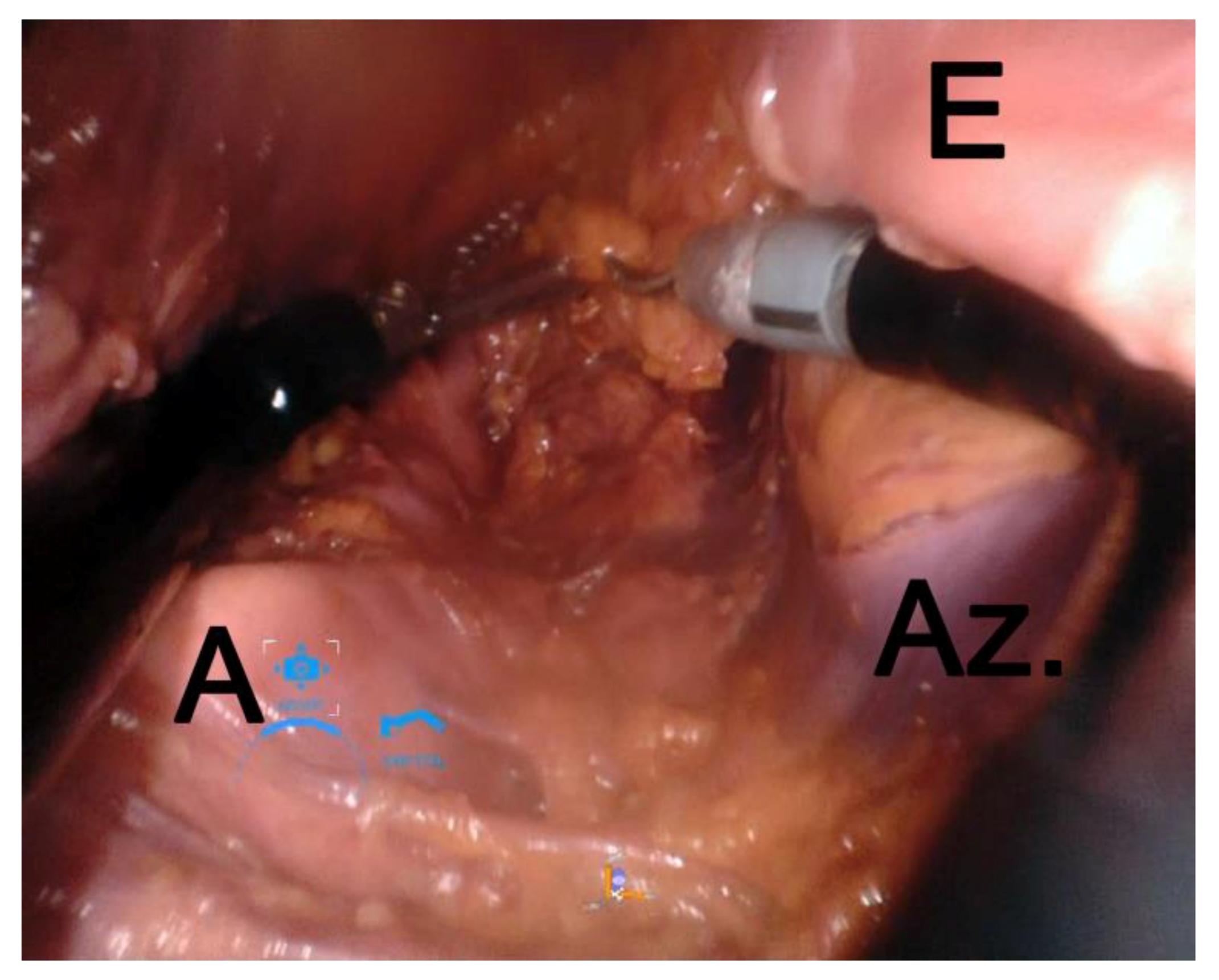 Applsci 09 03572 g005
