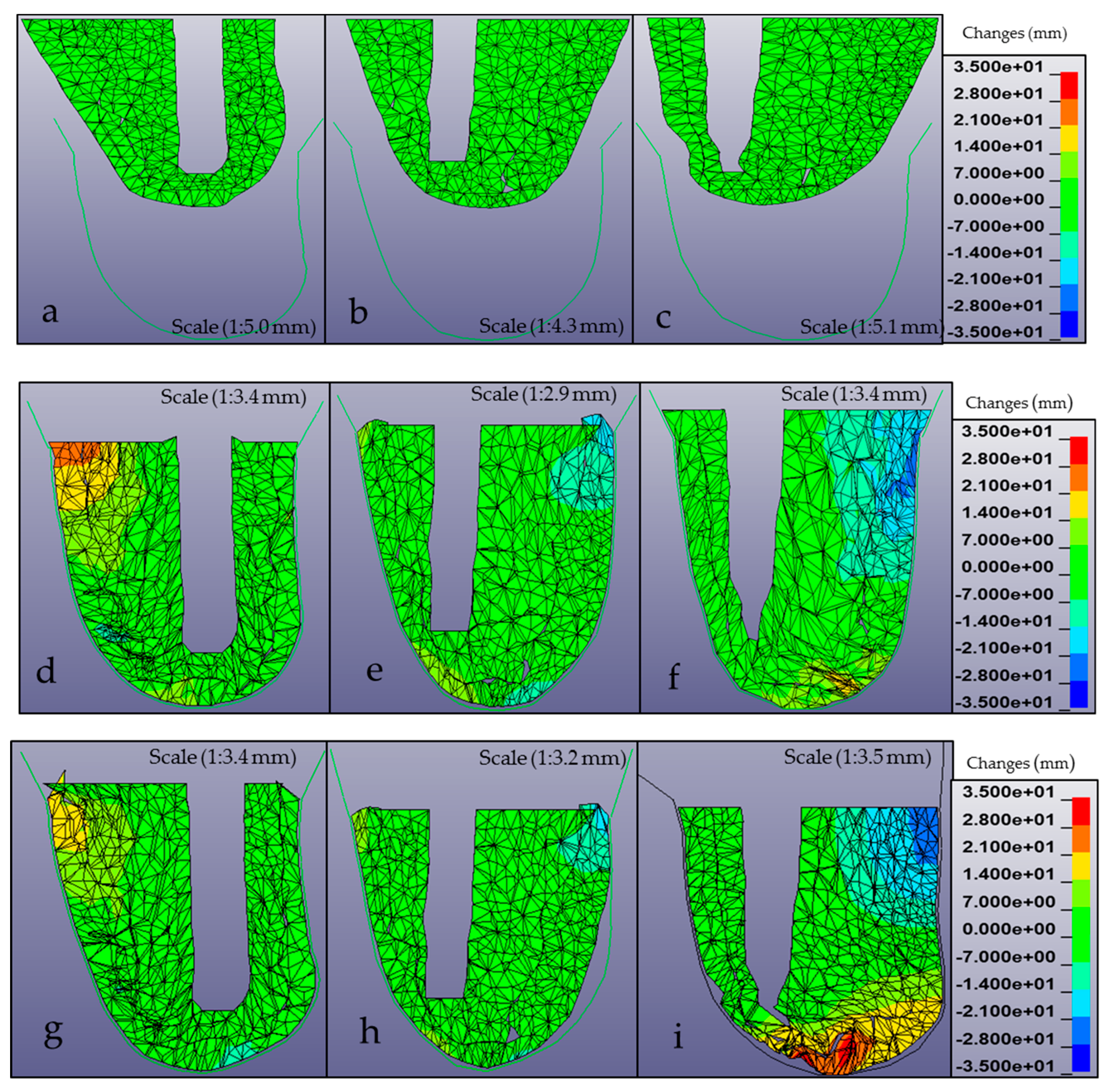 Applied Sciences Free Full Text Development Of An Evaluation System For Magnetic Resonance Imaging Based Three Dimensional Modeling Of A Transfemoral Prosthetic Socket Using Finite Elements Html Applied Sciences Free Full Text Development Of An Evaluation System For Magnetic Resonance Imaging Based Three Dimensional Modeling Of A Transfemoral Prosthetic Socket Using Finite Elements Html