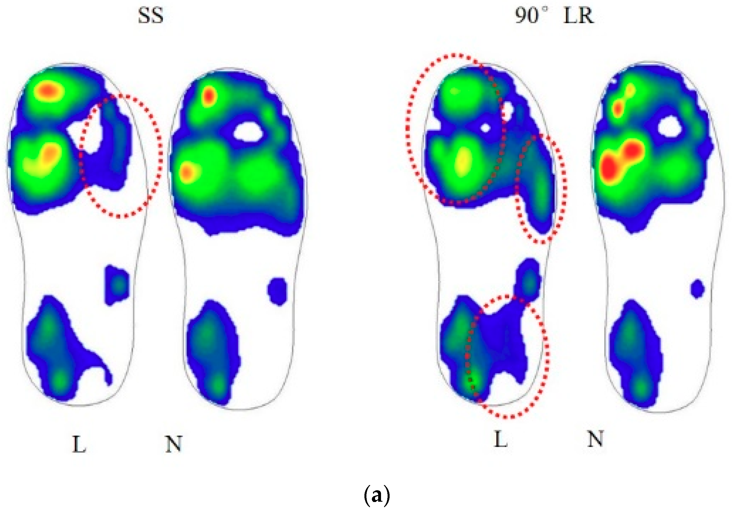 Applied Sciences | Free Full-Text | Shoe Cushioning Effects on Foot ...