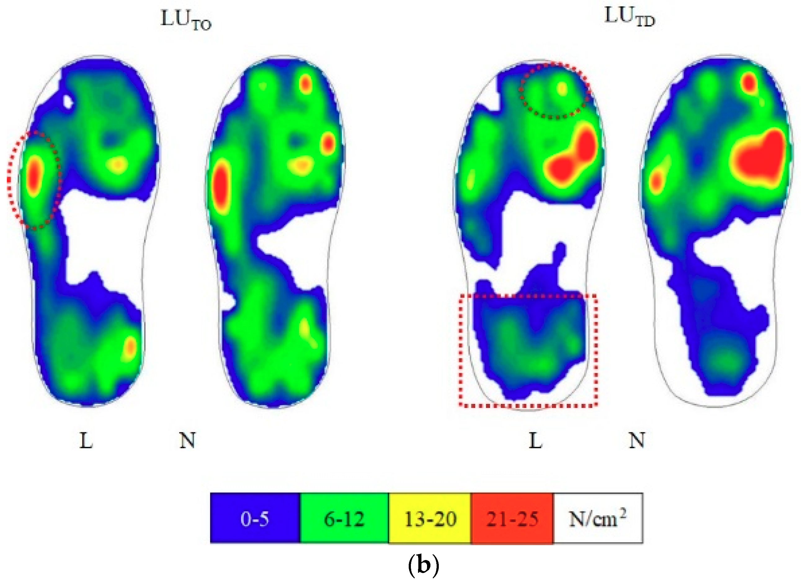 Applied Sciences Free FullText Shoe Cushioning Effects on Foot