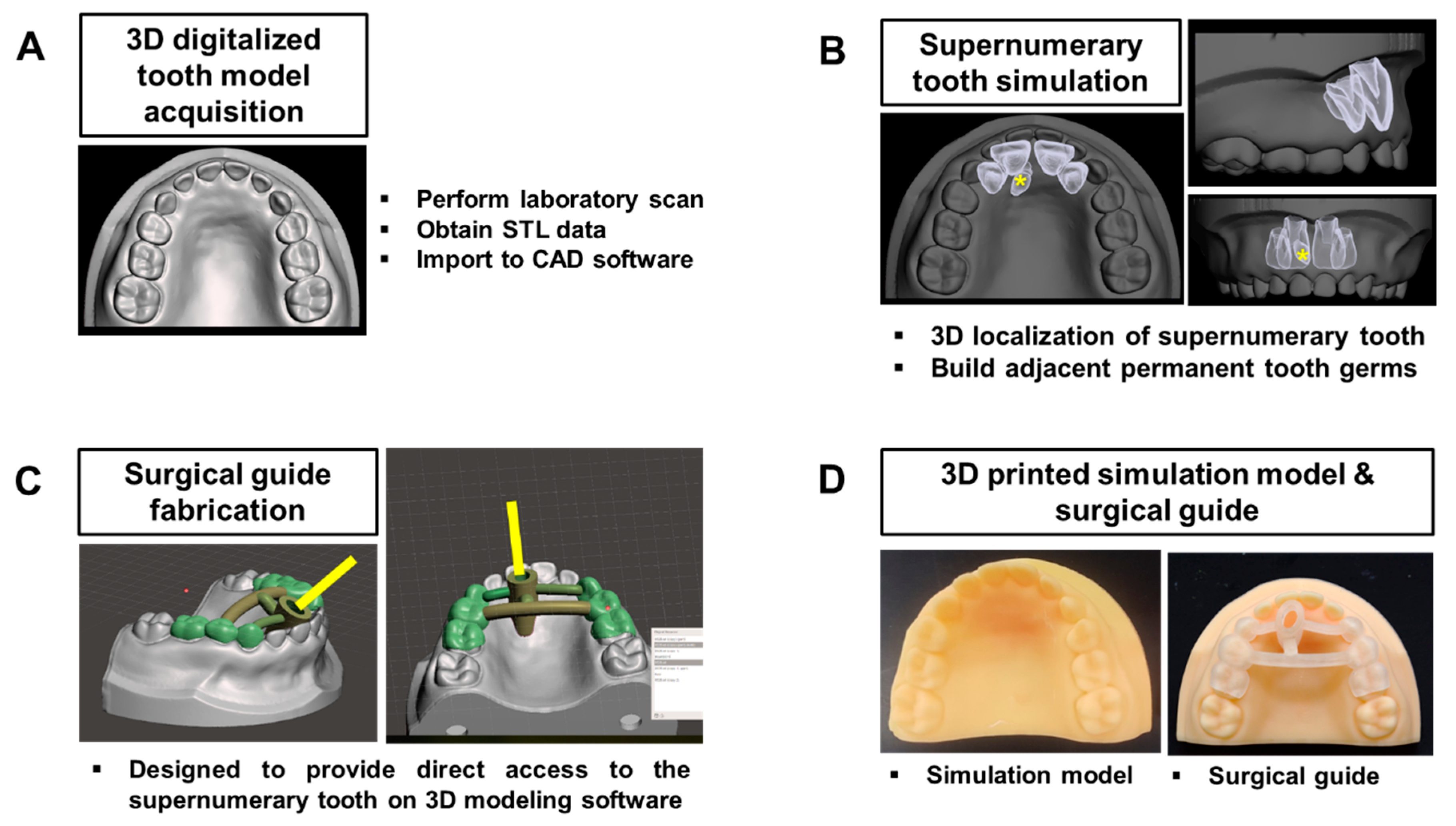 Applied Sciences Free FullText Feasibility of a 3D Surgical Guide
