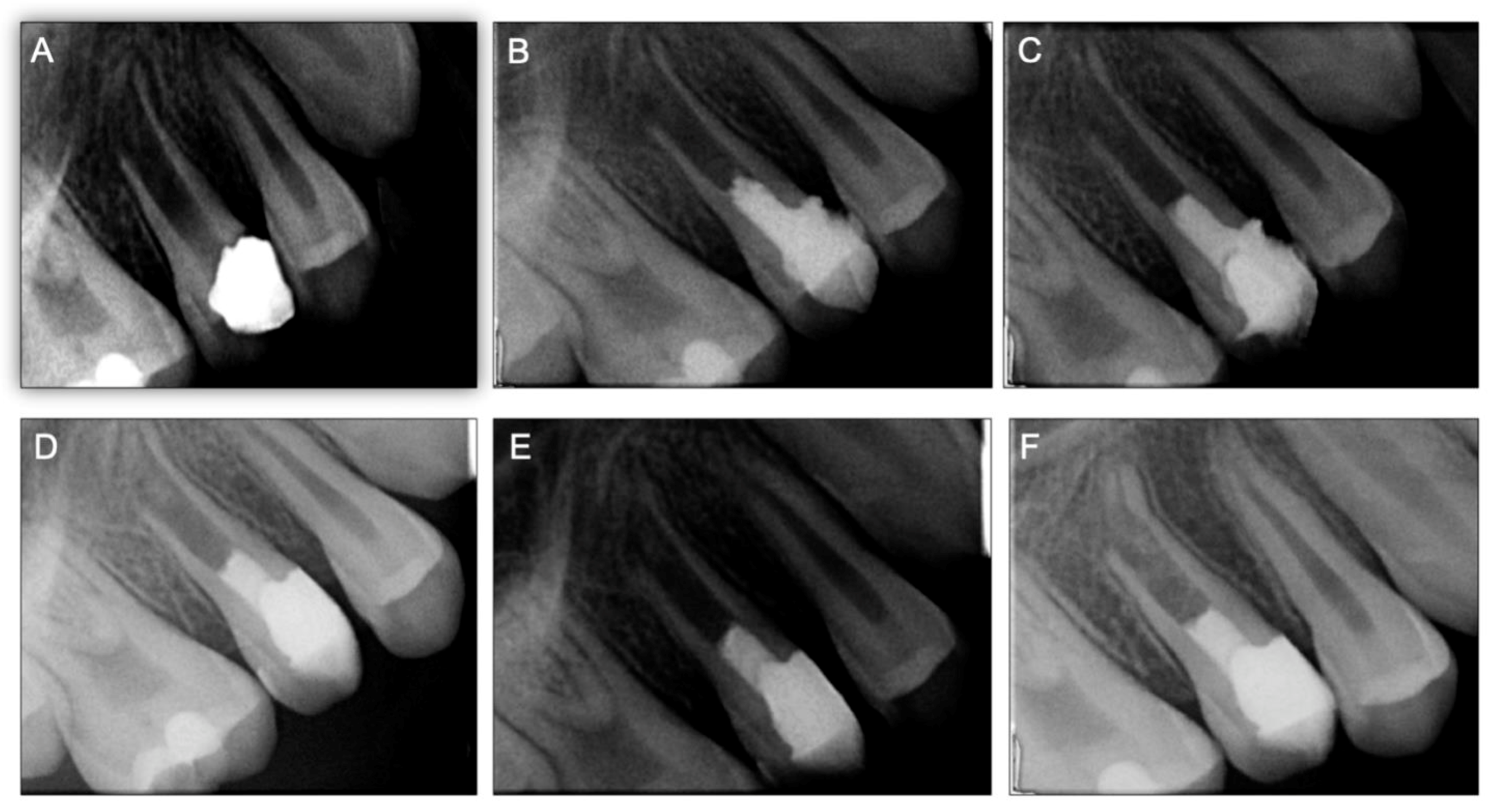 Applied Sciences Free FullText Does Apical Papilla Survive and