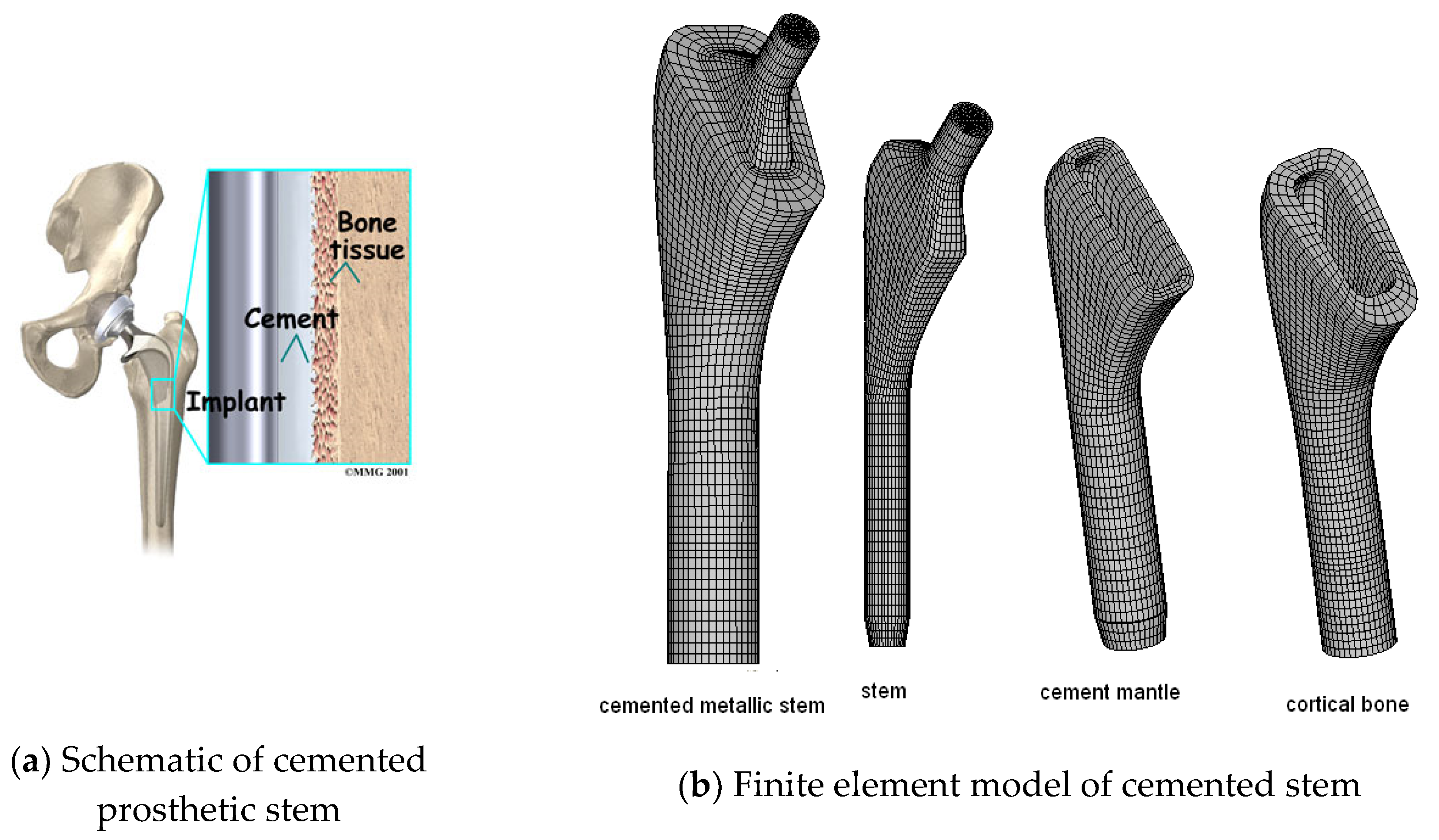 Applied Sciences Free FullText Biomechanical Performance of the