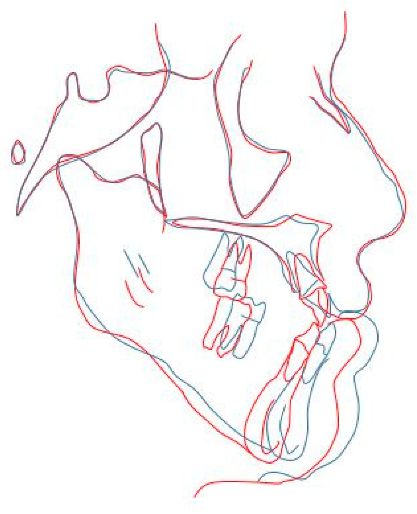 Applied Sciences Free Full Text 3d Soft Tissue Prediction Methodologies For Orthognathic Surgery A Literature Review Html