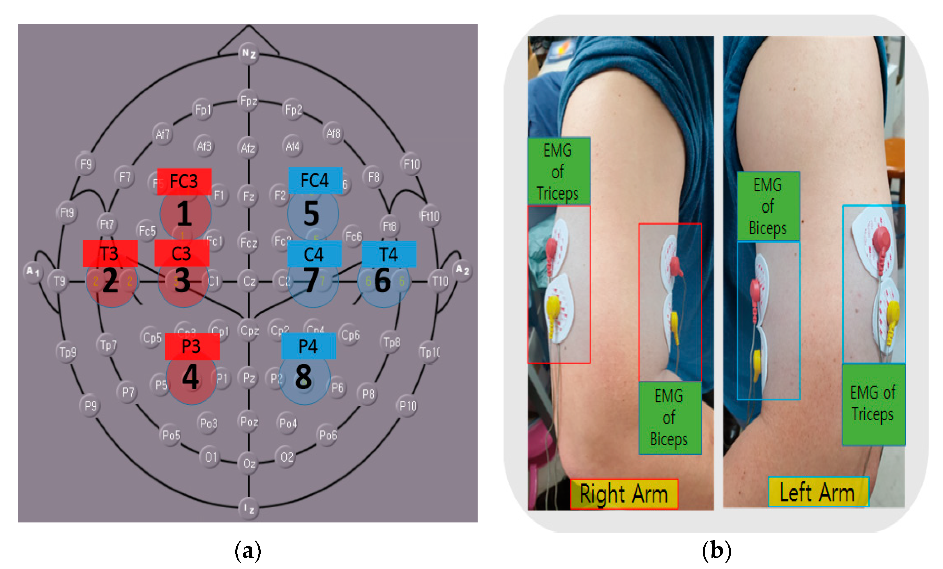 Eeg Signals Accurately Predict Autism >> Applied Sciences Free Full Text Motion Recognition And Eeg Signals Accurately Predict Autism >> Applied Sciences Free Full Text Motion Recognition And
