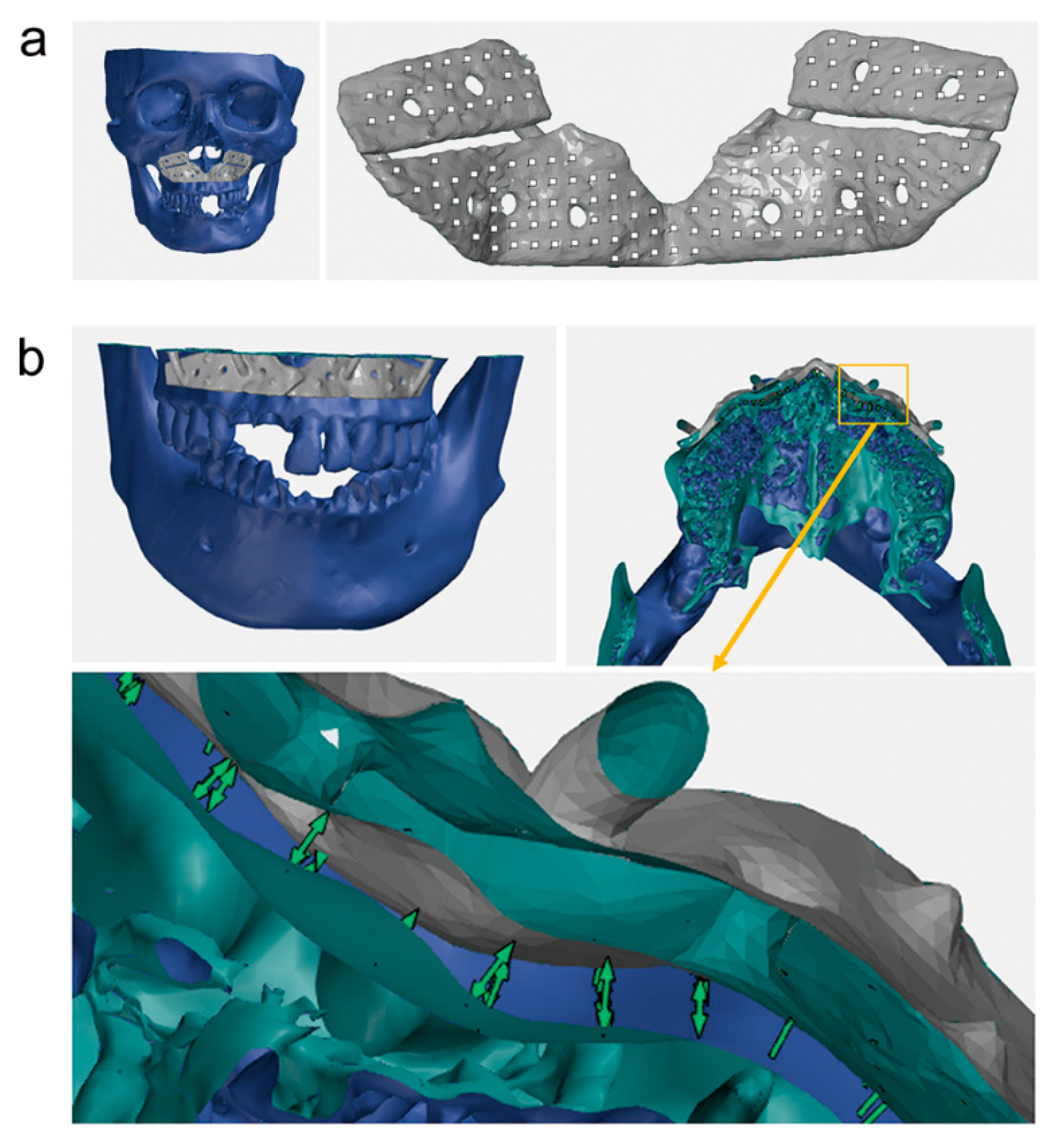 Applsci 09 04928 g003