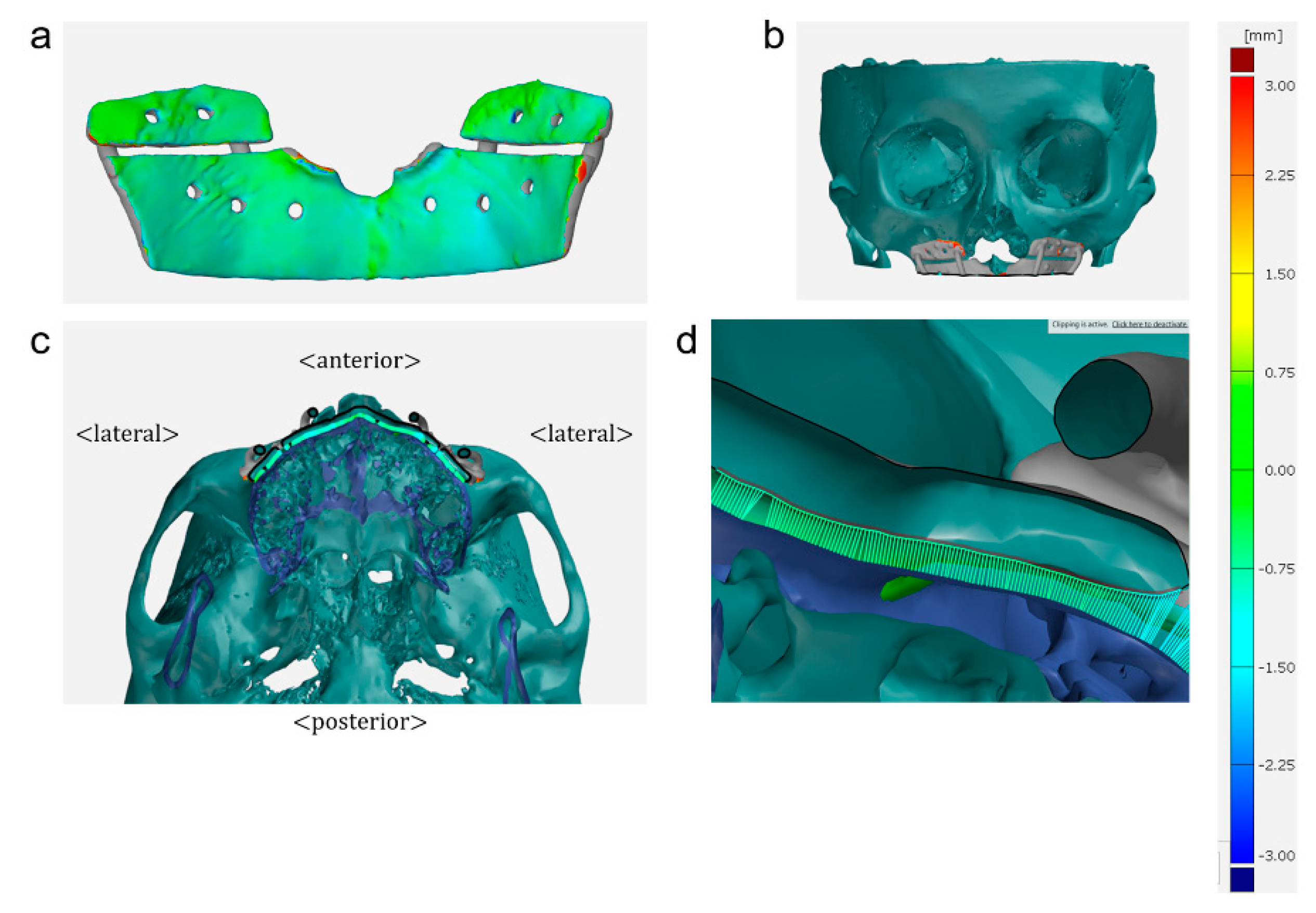 Applsci 09 04928 g004