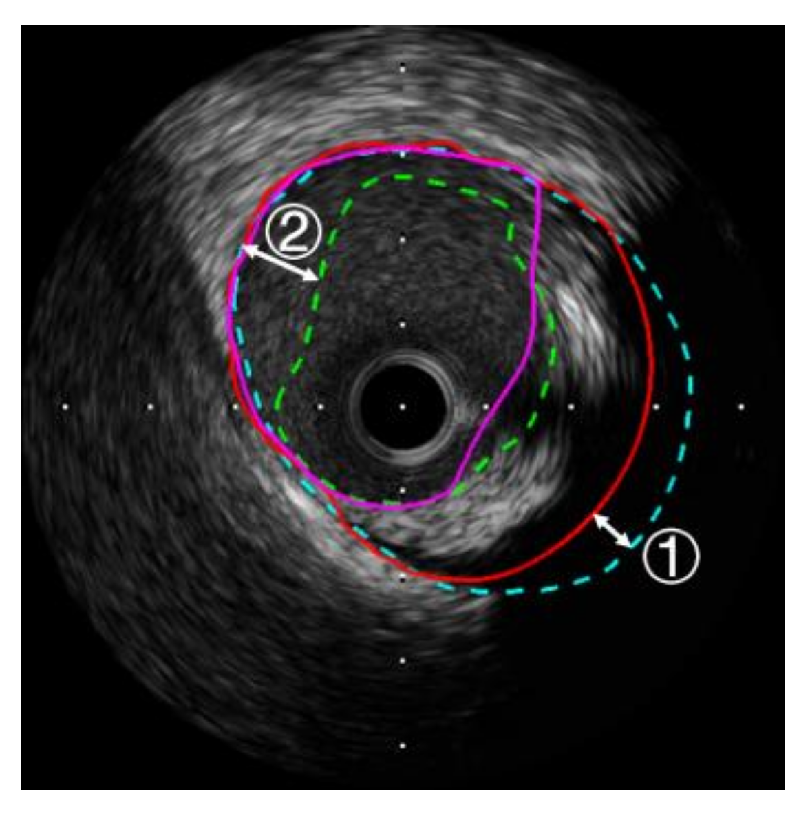 Applsci 09 04967 g011 Applsci 09 04967 g011