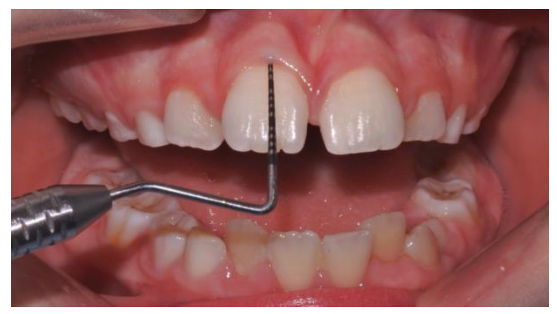 Applsci 09 05057 g002 Applsci 09 05057 g002