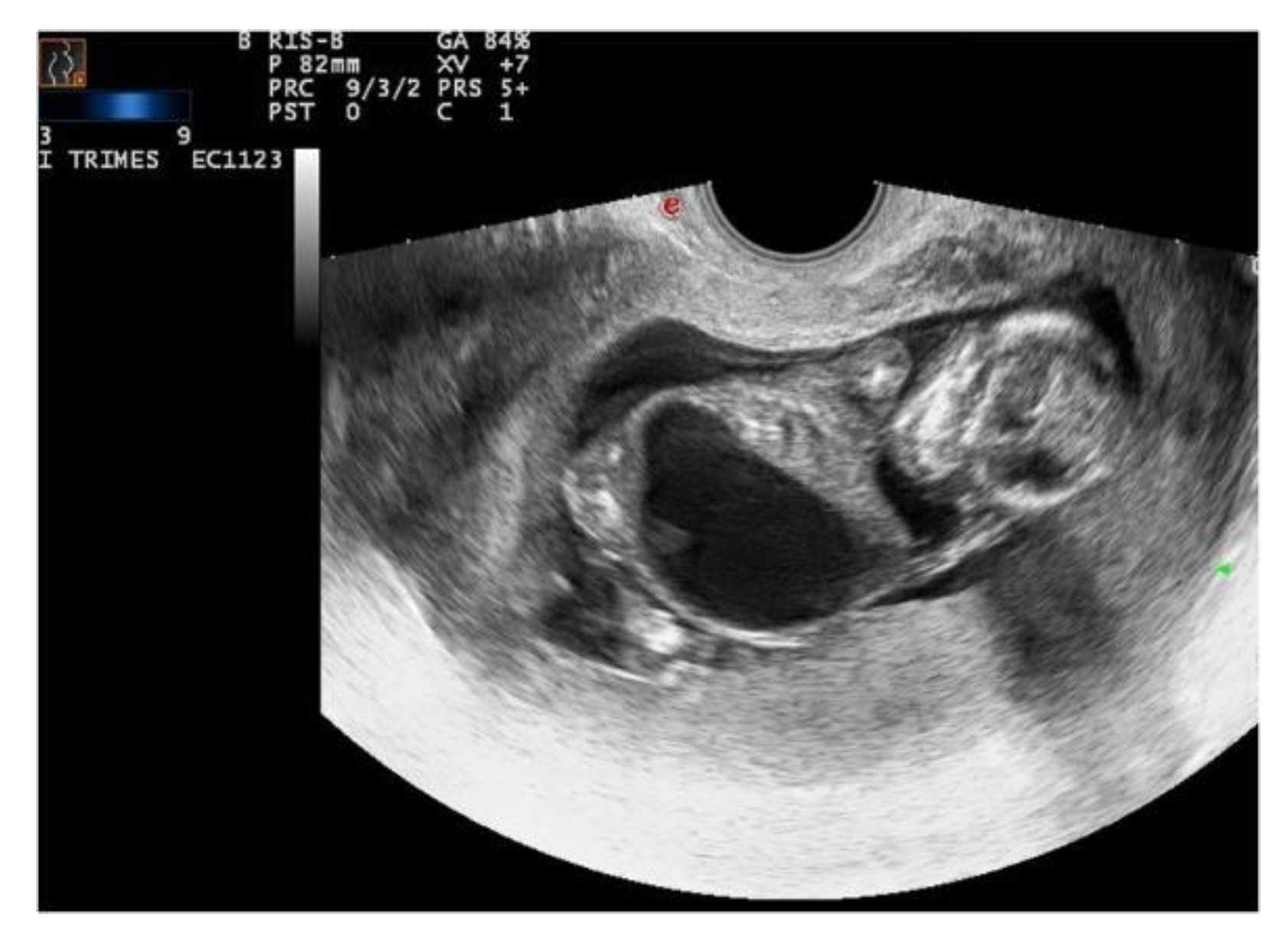 Applsci 09 05155 g002 550