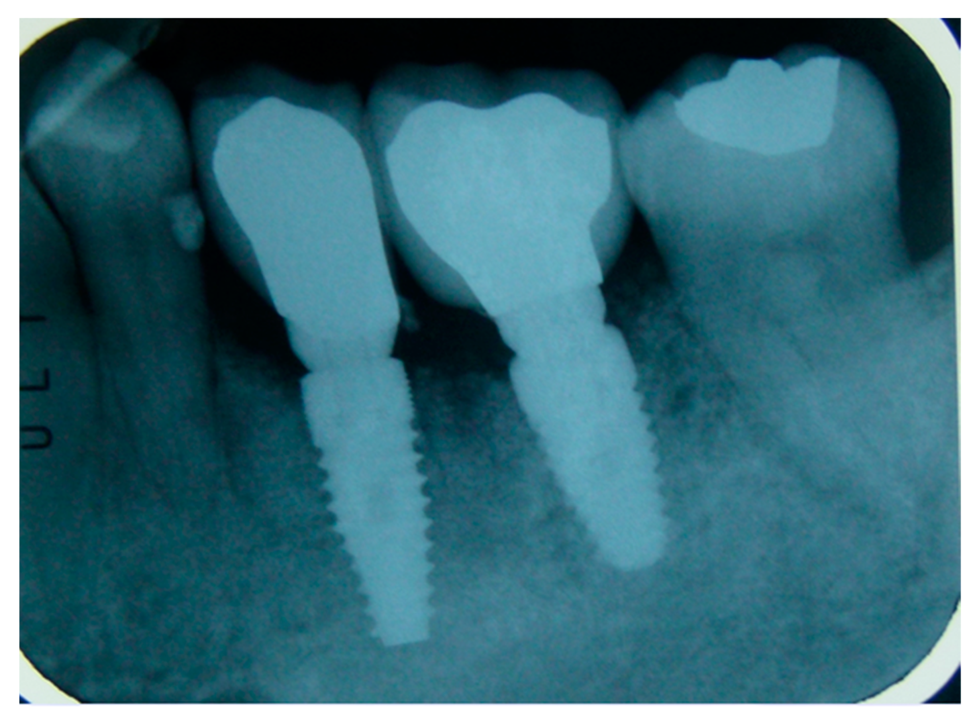 Applsci 09 05396 g005 Applsci 09 05396 g005