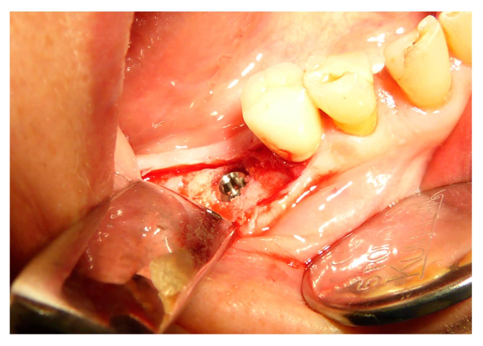 Applsci 09 05396 g010 Applsci 09 05396 g010