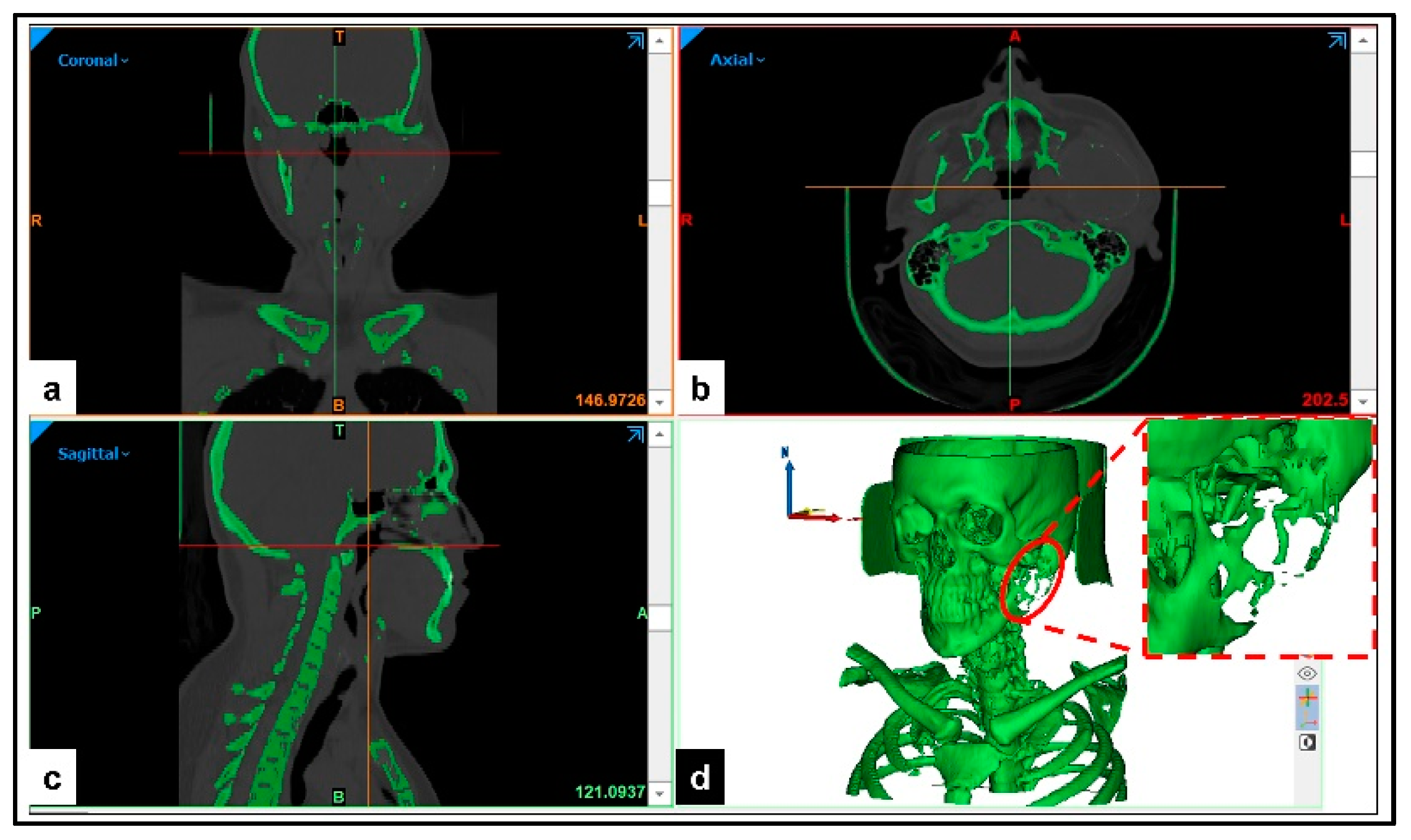 Applsci 09 05455 g001