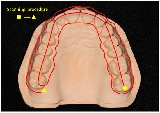 Accuracy of Five Intraoral Scanners and Two Laboratory Scanners for a ...