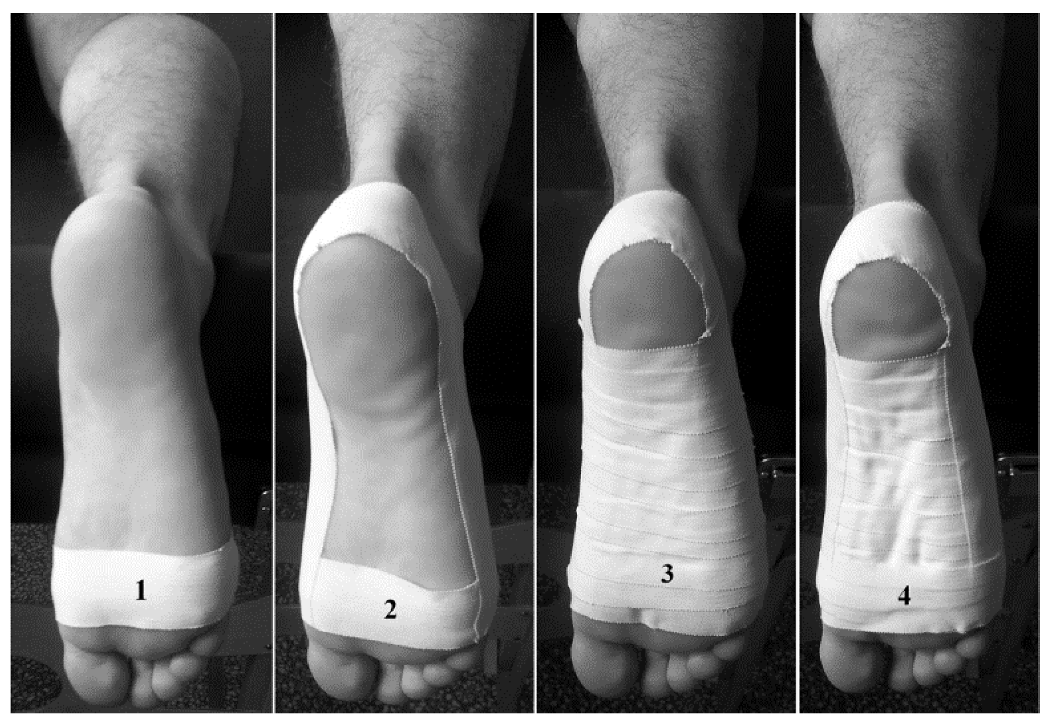 Taping on sale foot arch