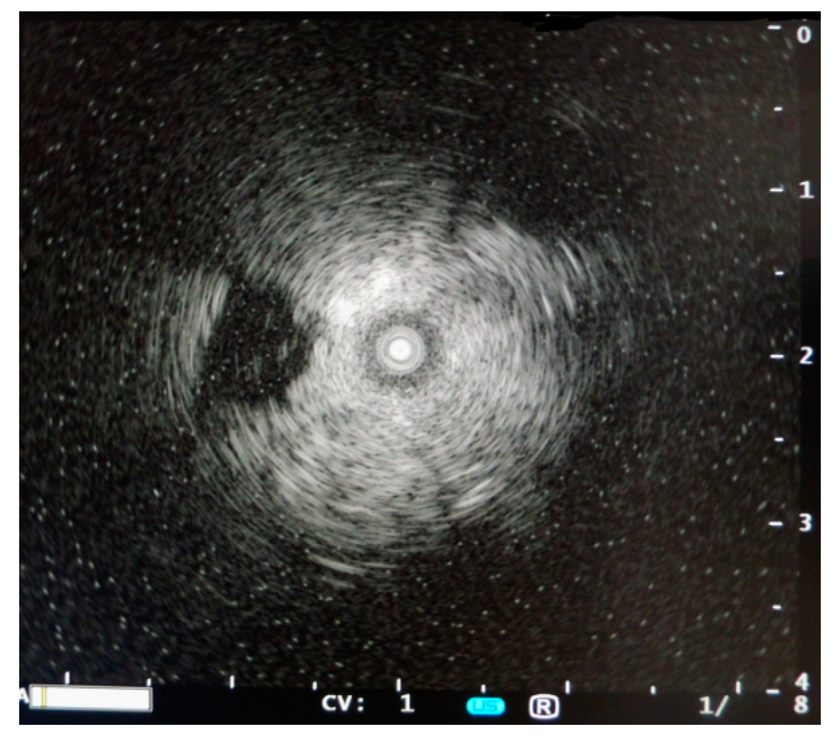 Applsci 10 00574 g007