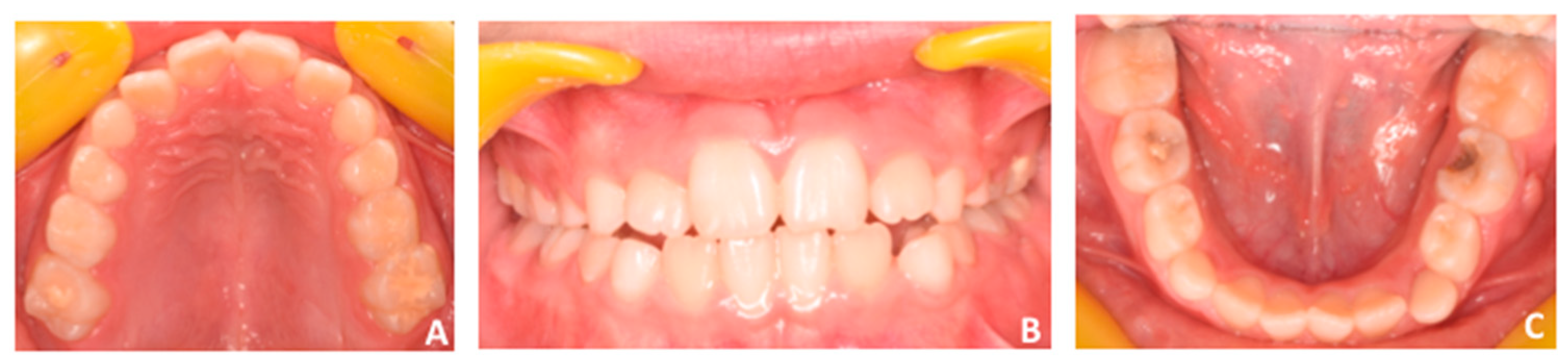 Applsci 10 01495 g012