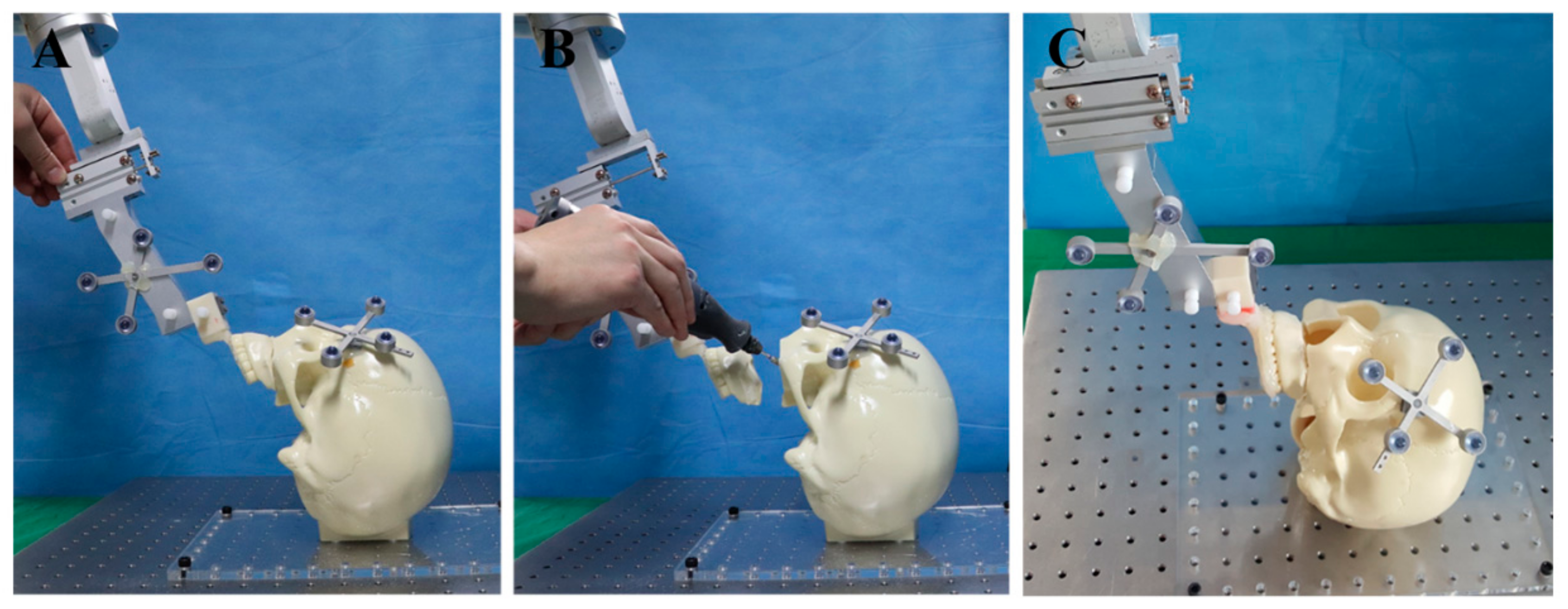 Applsci 10 01549 g005