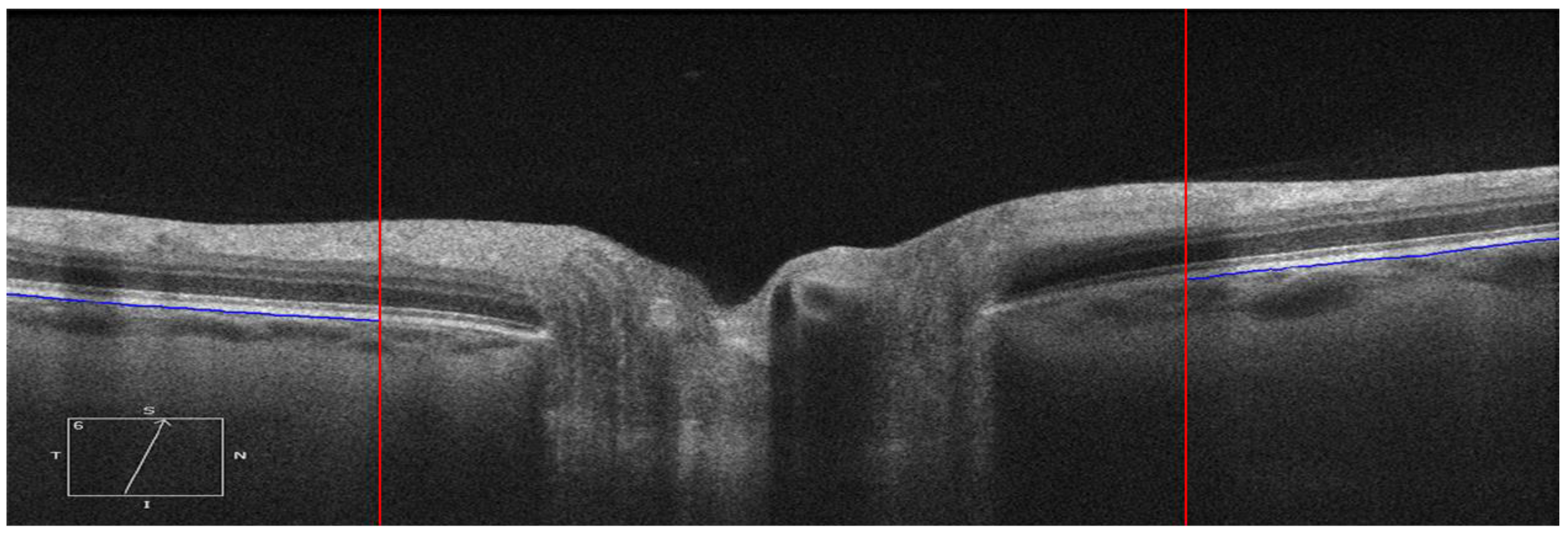 Applsci 10 01559 g002a Applsci 10 01559 g002a