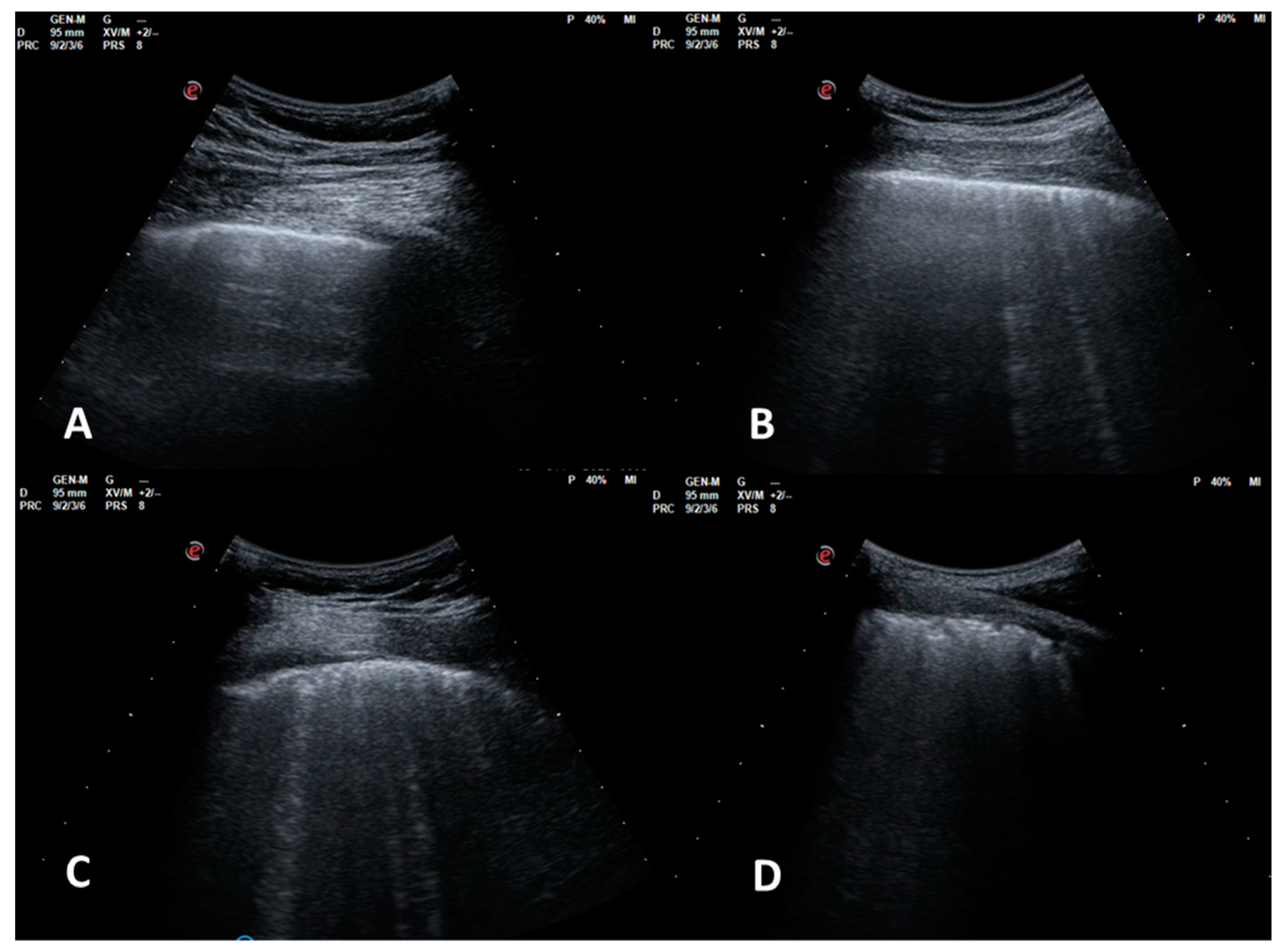 Applsci 10 01617 g001 Applsci 10 01617 g001
