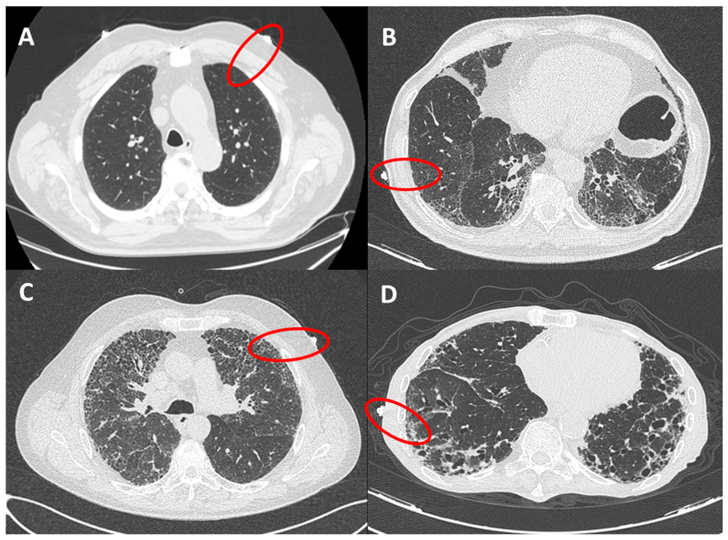 Applsci 10 01617 g002 Applsci 10 01617 g002