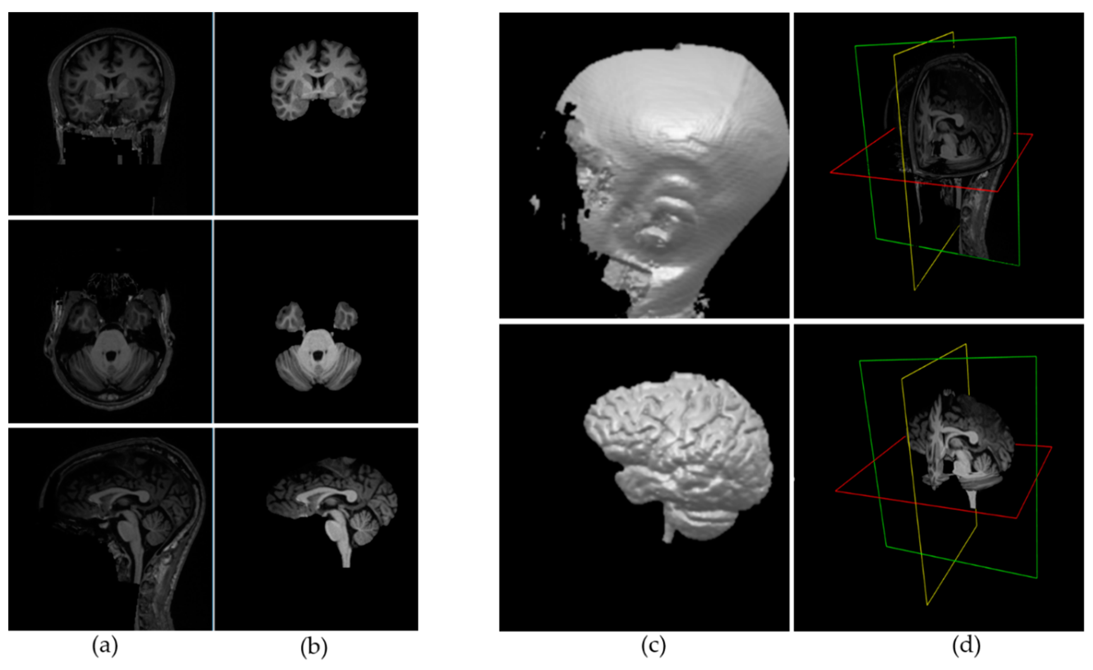 hippocampus anatomy 2d