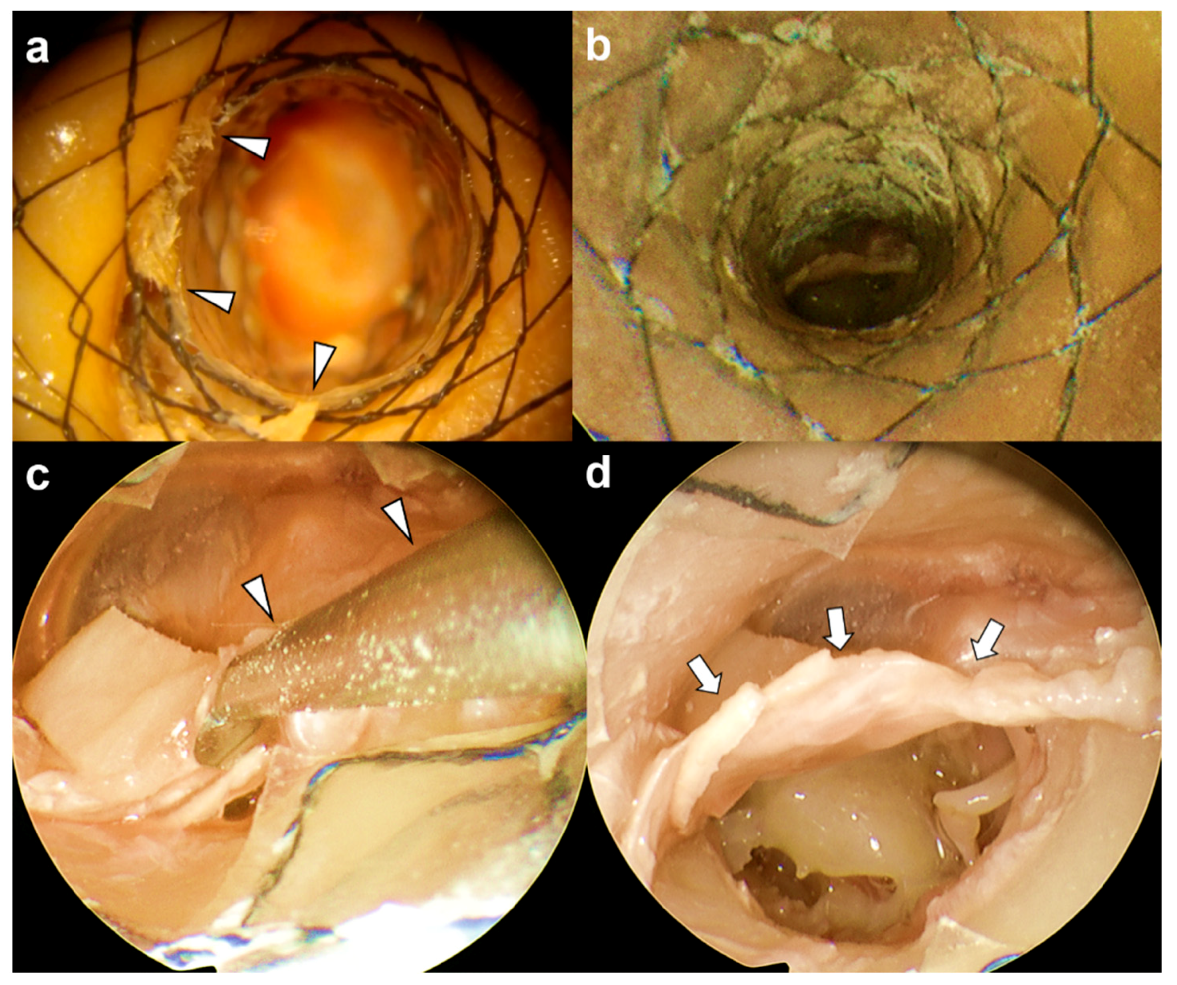 Applsci 10 01877 g004