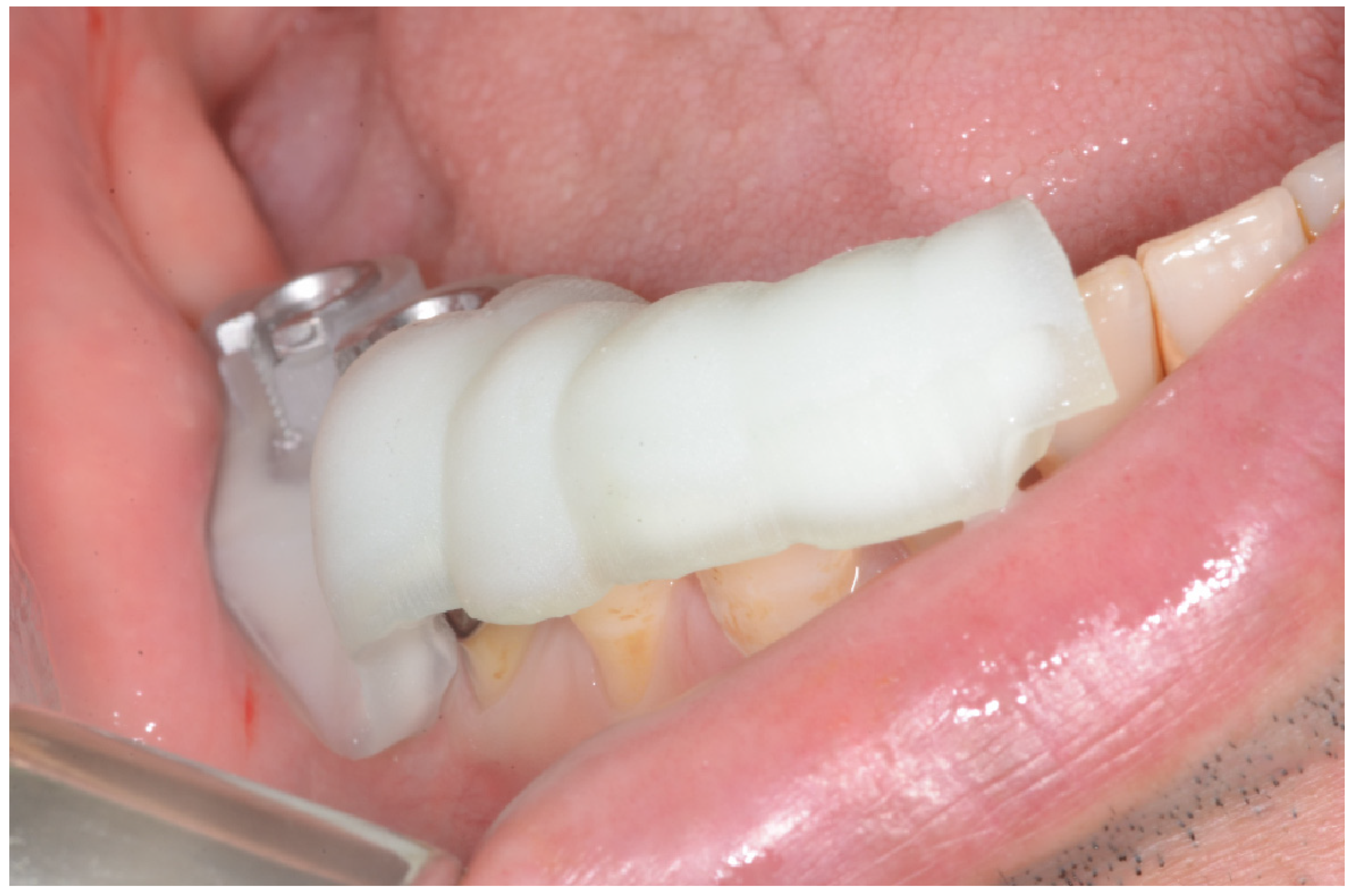 Applsci 10 01975 g002