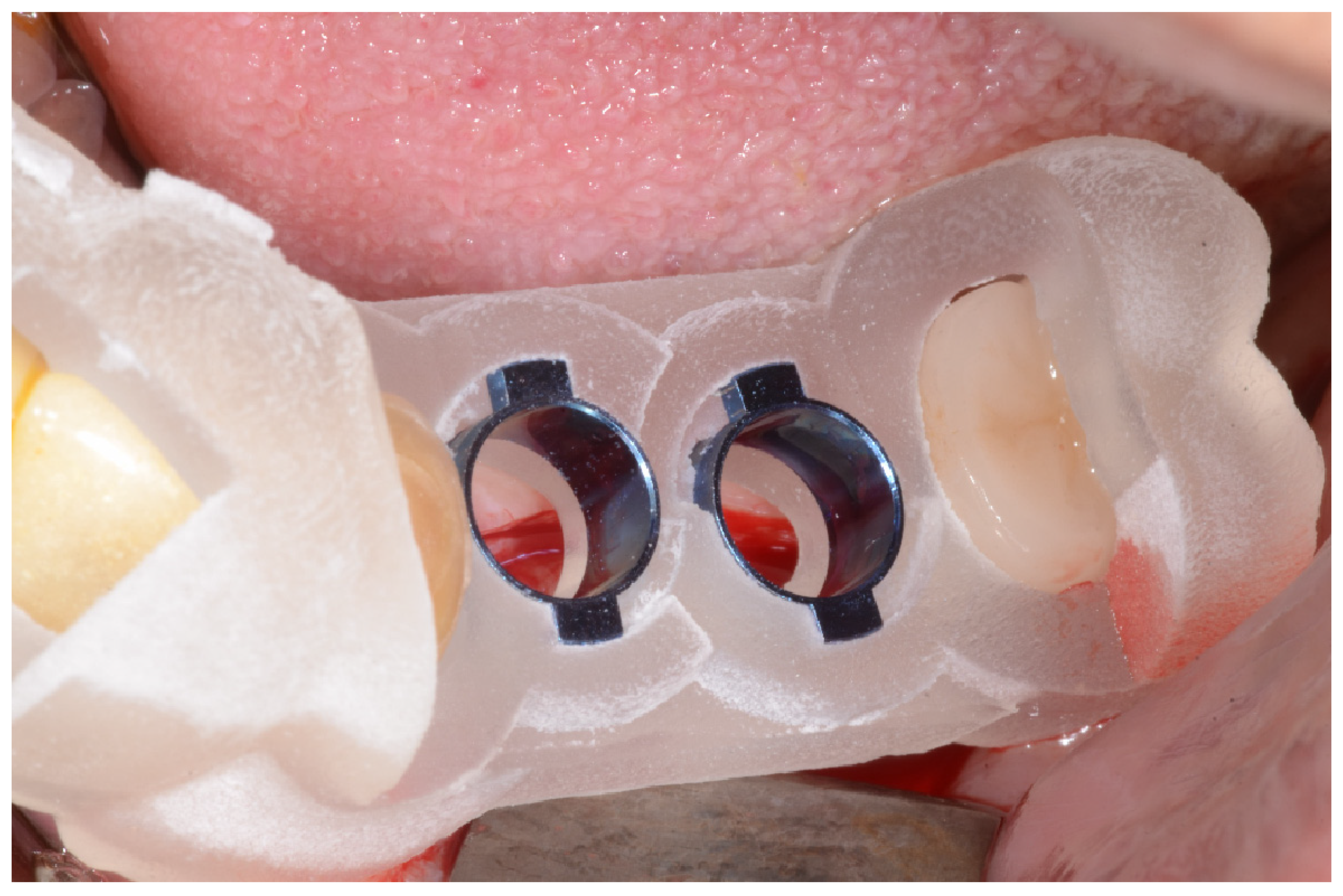 Applsci 10 01975 g004