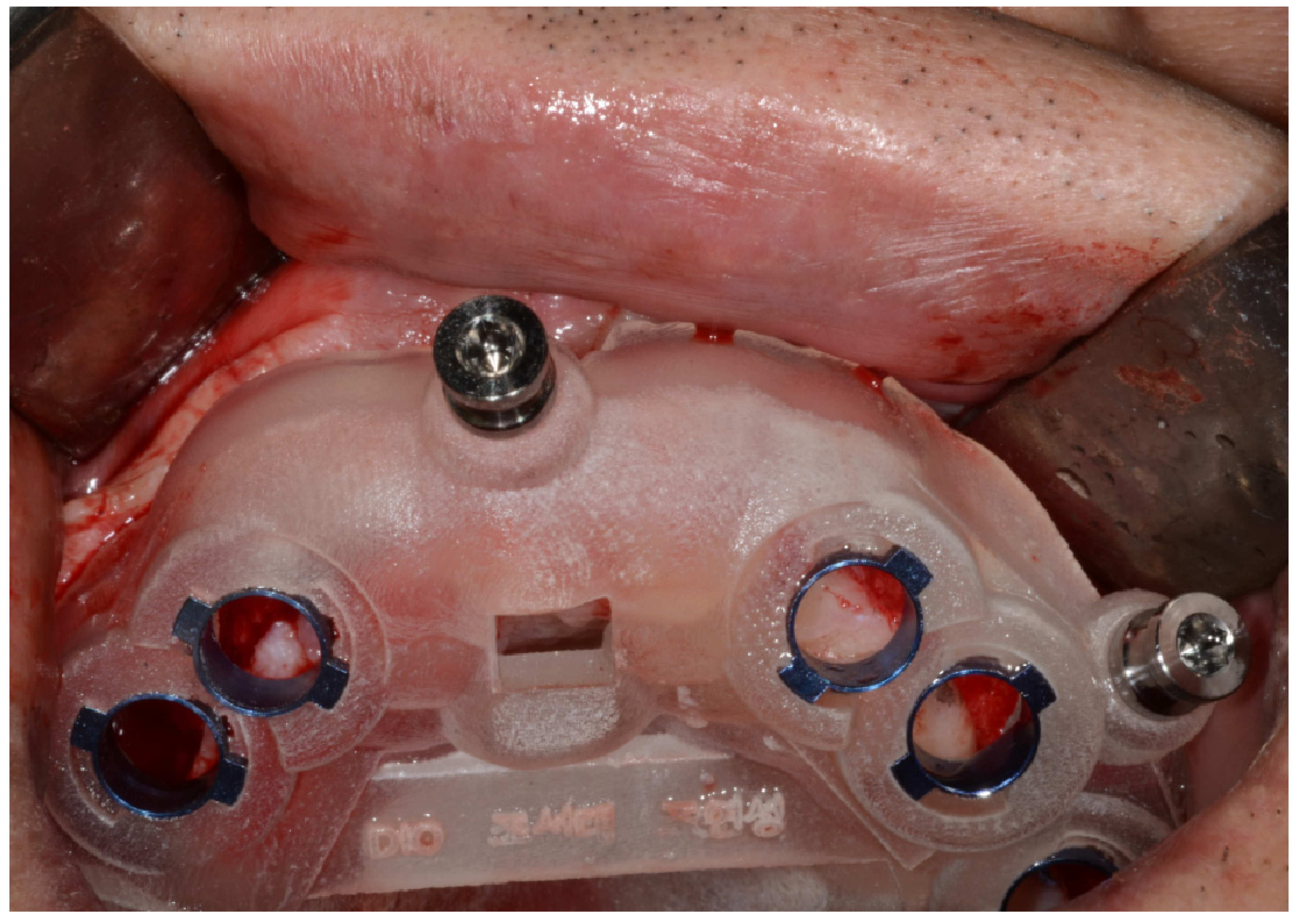 Applsci 10 01975 g005