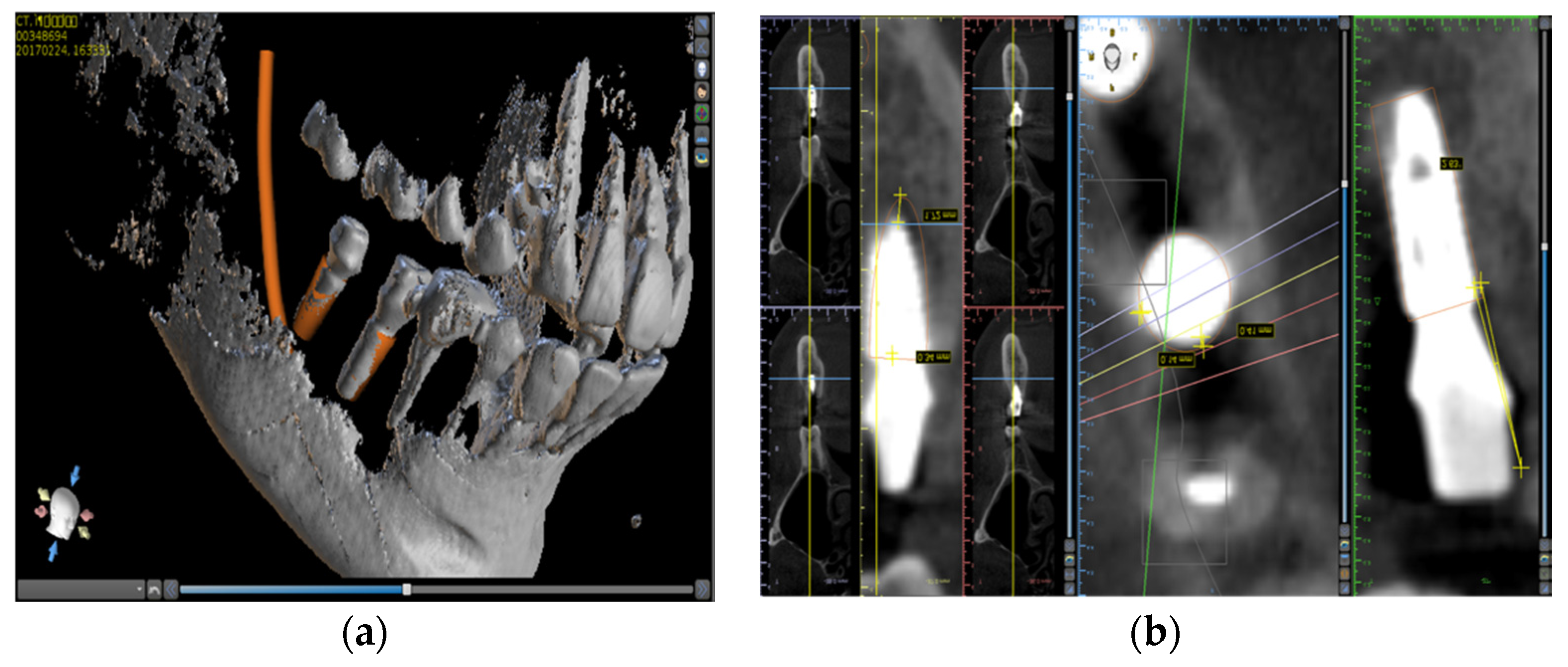 Applsci 10 01975 g006