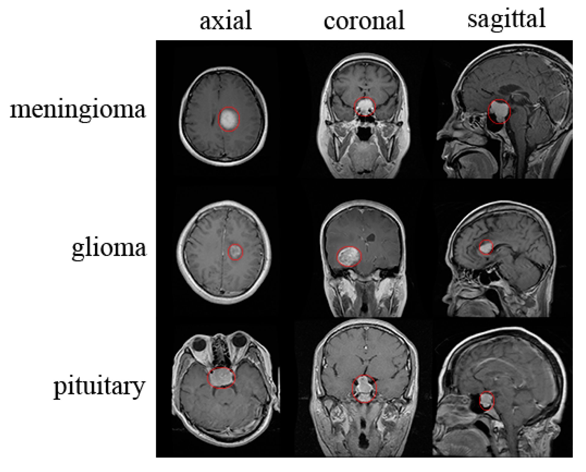 Applied Sciences | Free Full-Text | Classification of Brain ...