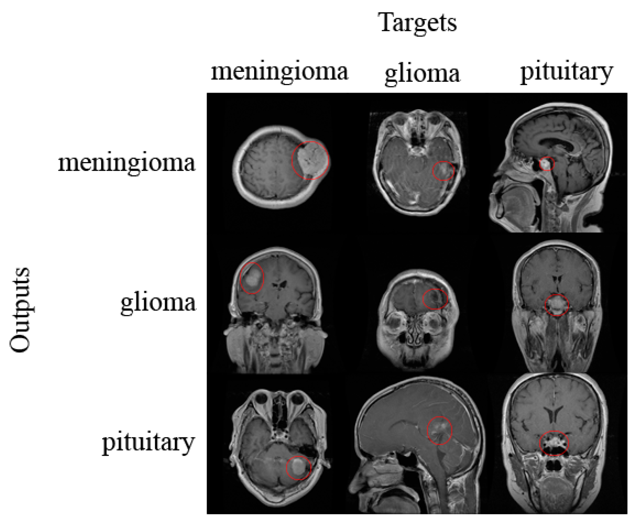 The test database of MR brain images and corresponding results for the