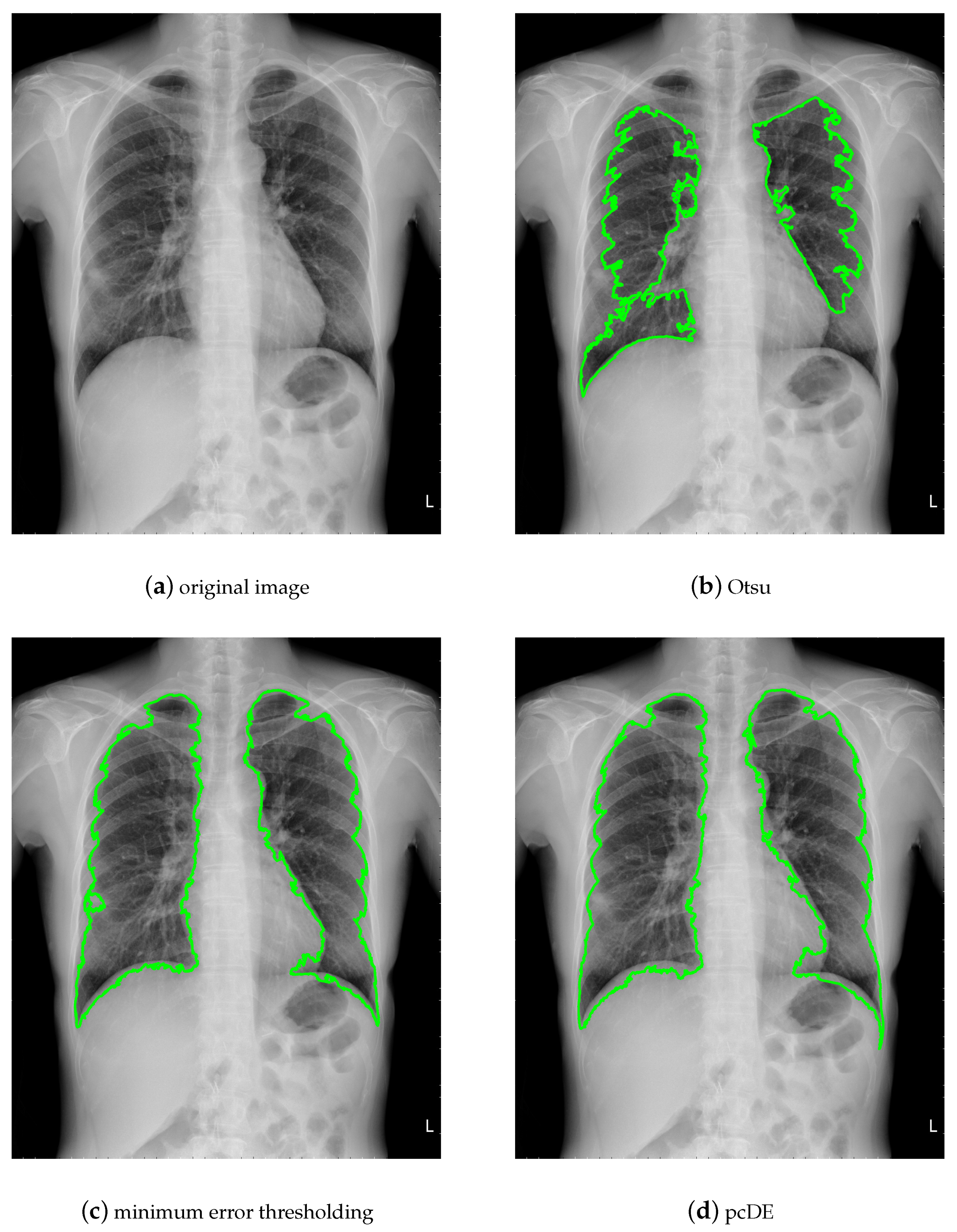 Applsci 10 02195 g010 Applsci 10 02195 g010