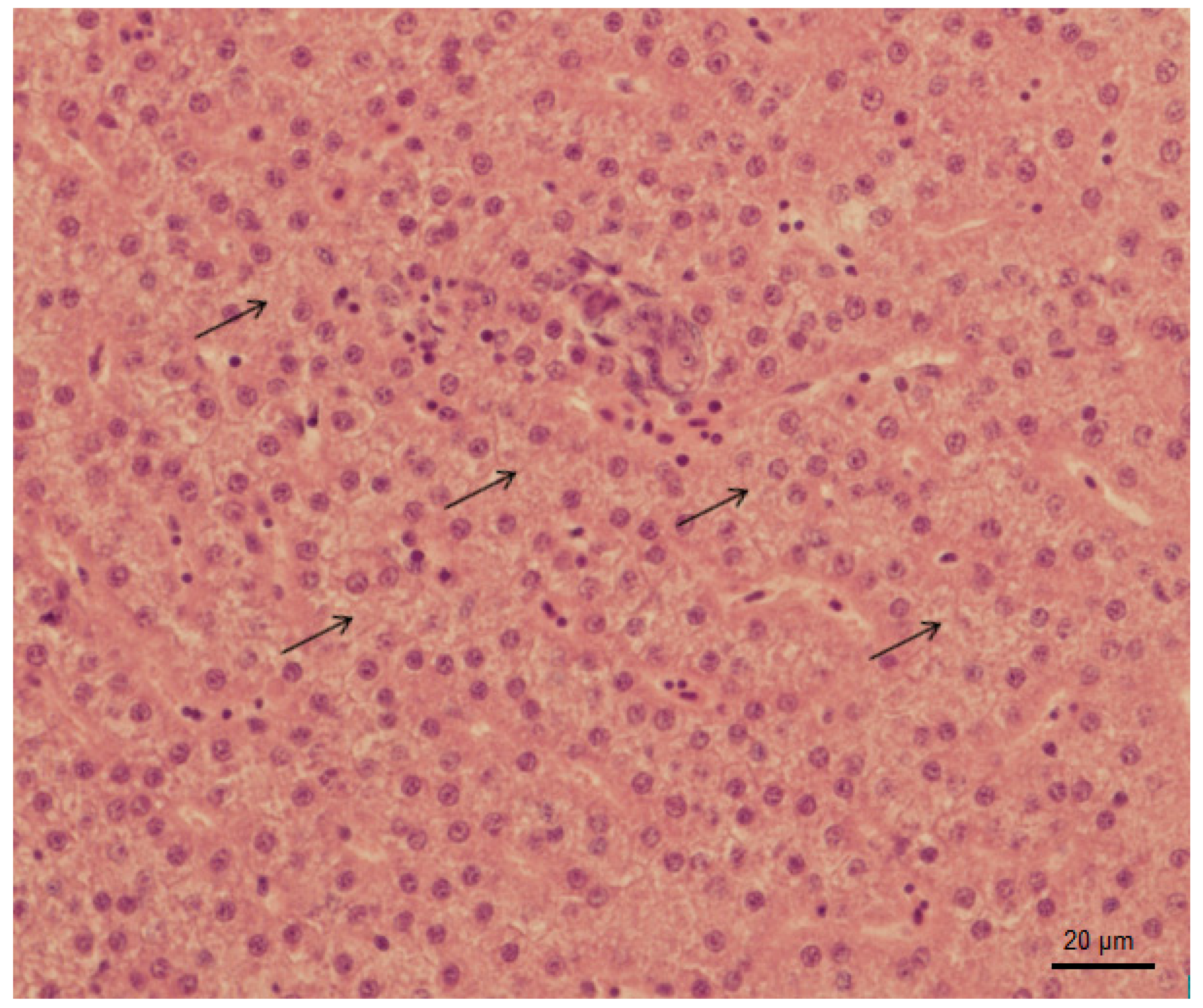 Applied Sciences Free Full Text Evaluation Of Tramadol Hydrochloride Toxicity To Juvenile Zebrafish Morphological Antioxidant And Histological Responses Html Applied Sciences Free Full Text Evaluation Of Tramadol Hydrochloride Toxicity To Juvenile Zebrafish Morphological Antioxidant And Histological Responses Html