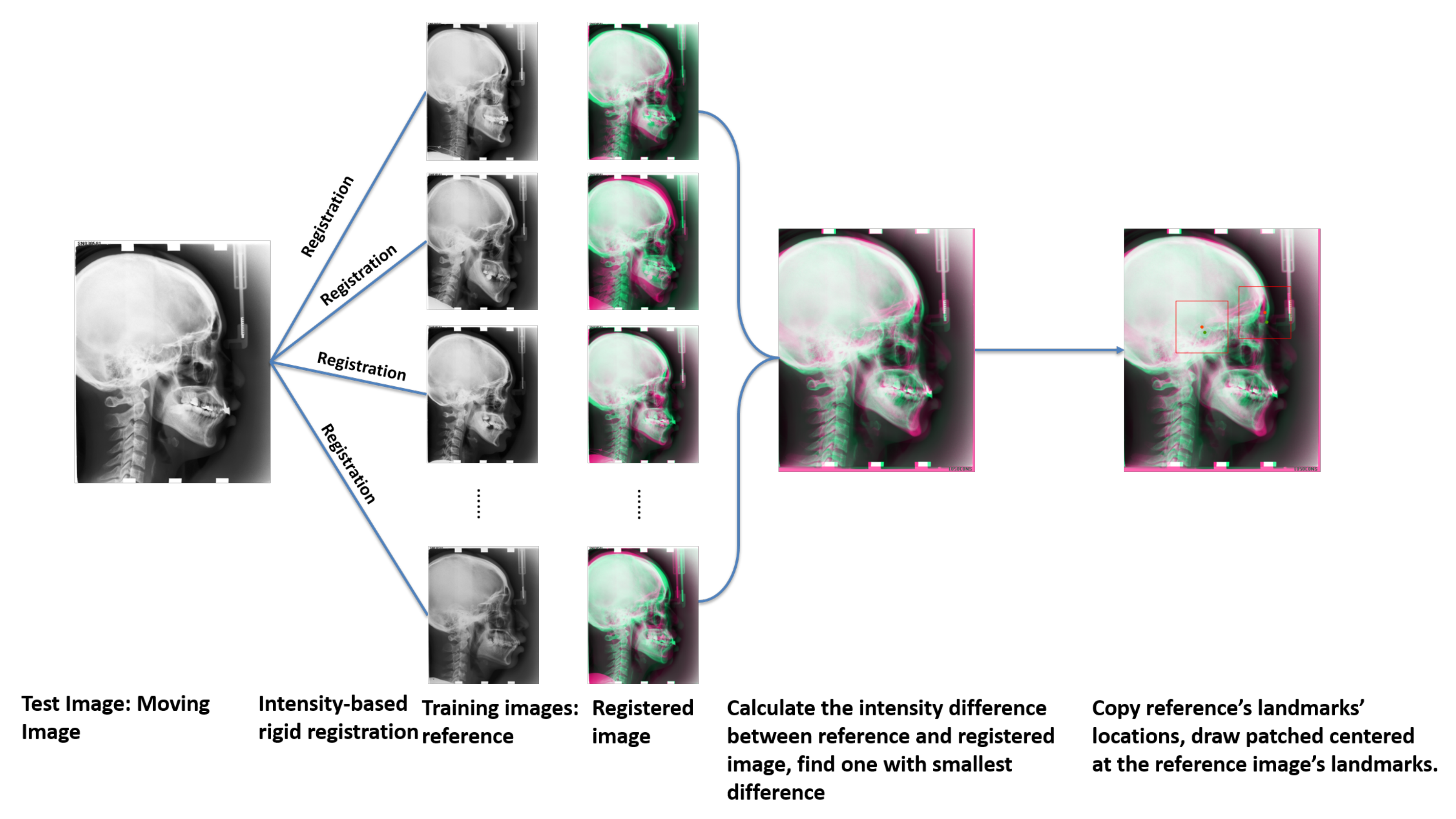 Applied Sciences Free FullText Automatic Cephalometric Landmark