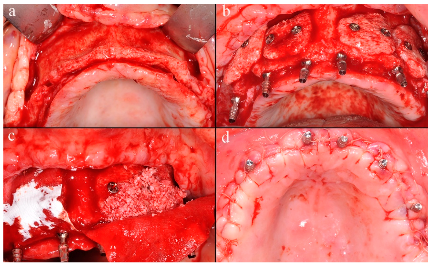 Applsci 10 02659 g002