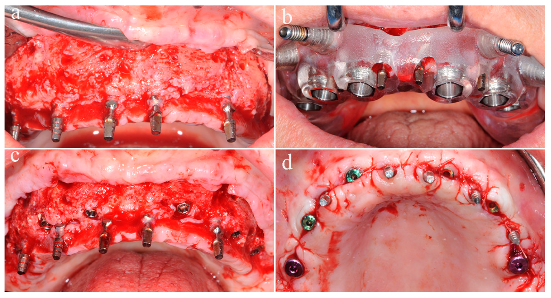 Applsci 10 02659 g003