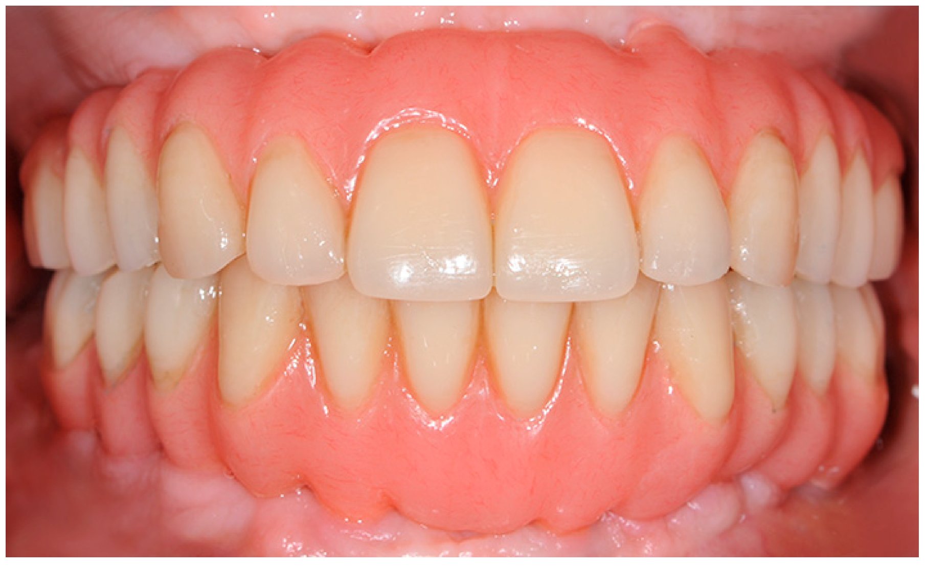 Applsci 10 02659 g004