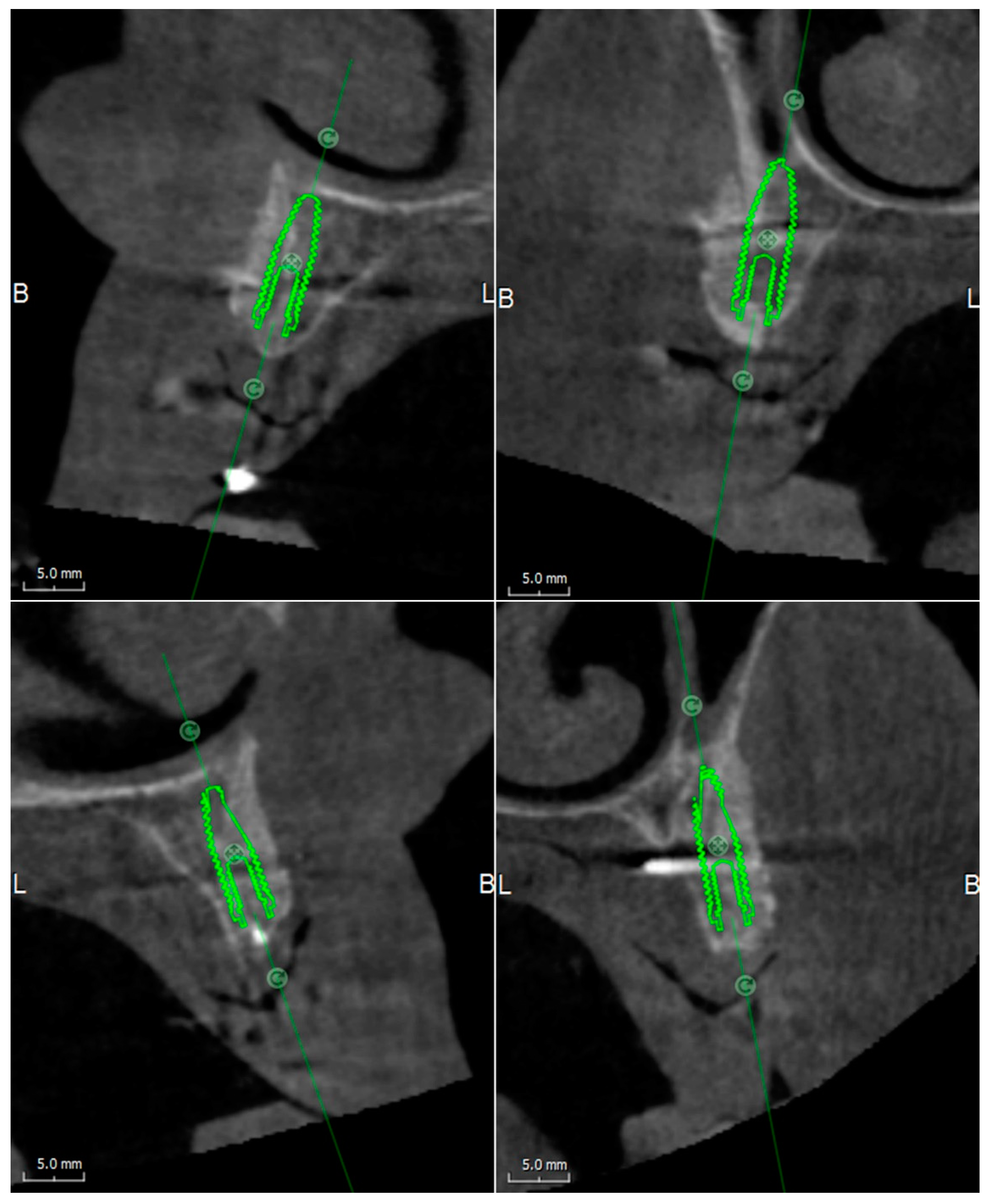 Applsci 10 02659 g005