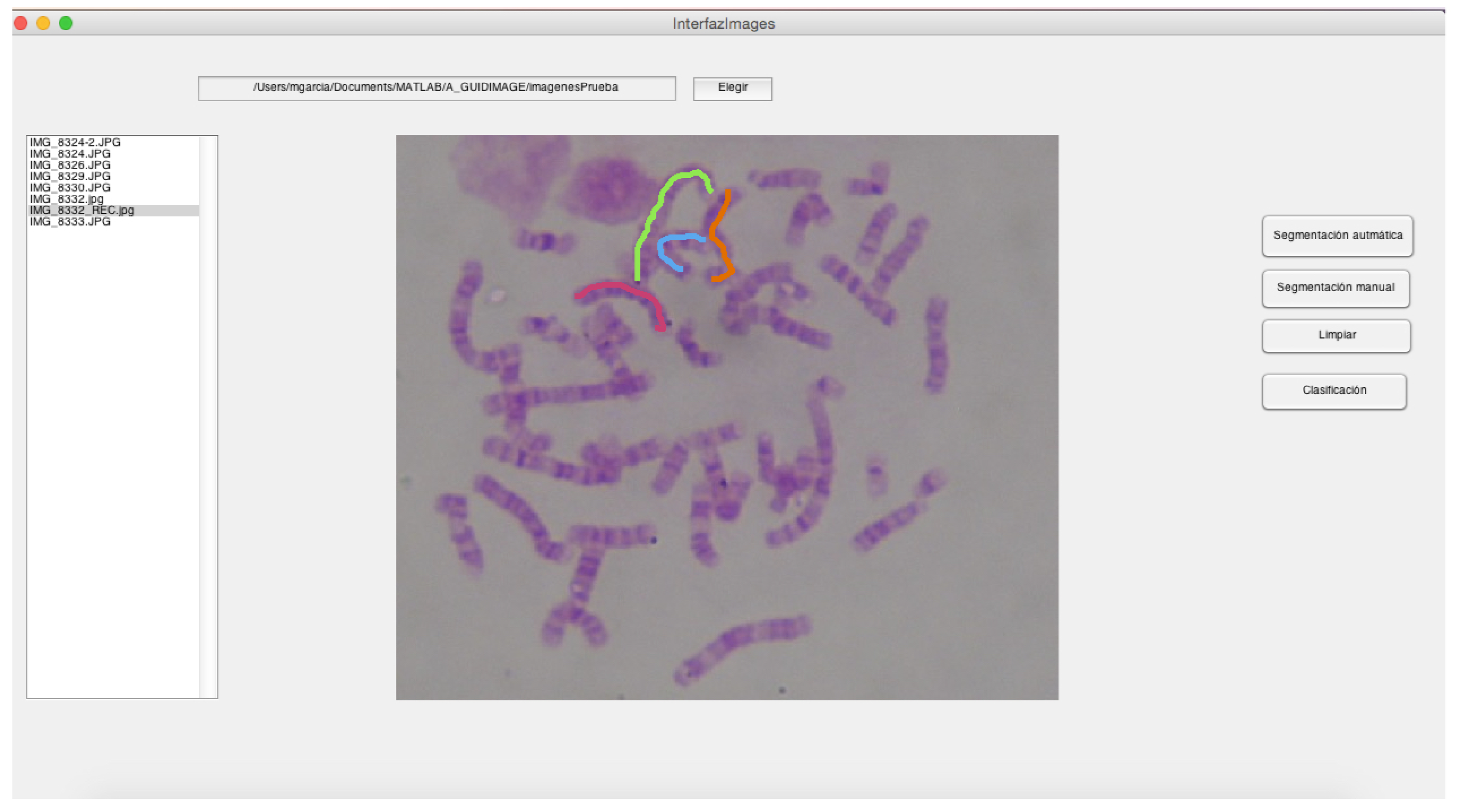 Applsci 10 02758 g017 Applsci 10 02758 g017