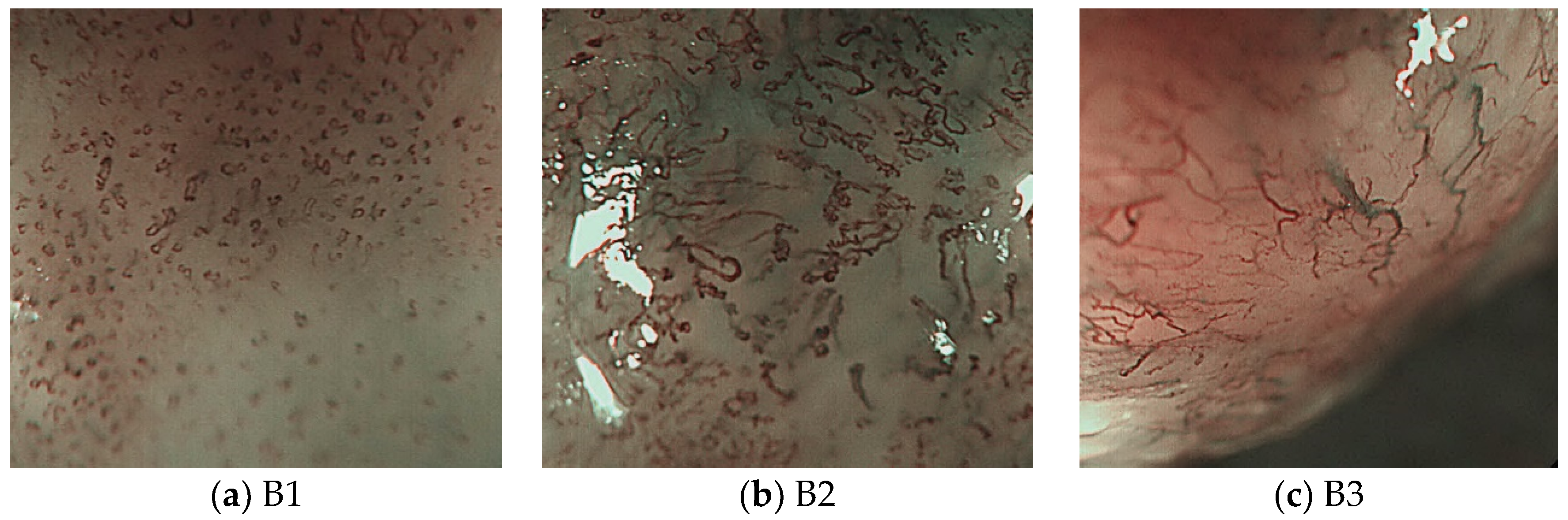 Applsci 10 02771 g013 Applsci 10 02771 g013