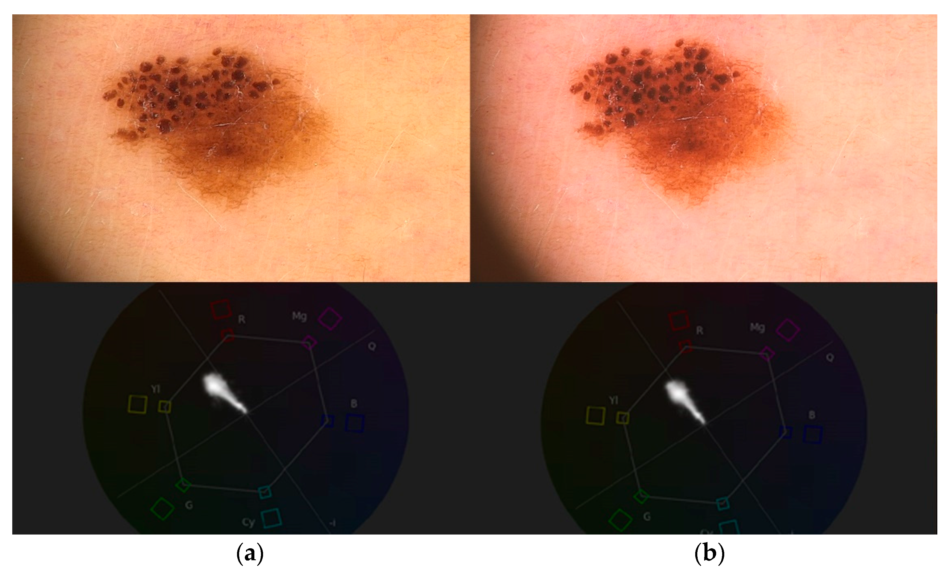 Applsci 10 02876 g011