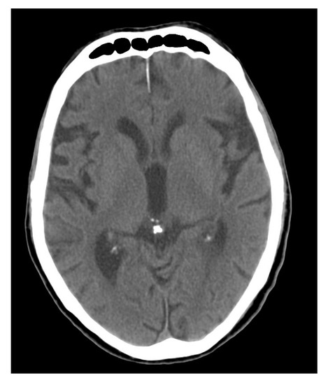 applsci-10-02885-g004-550.jpg
