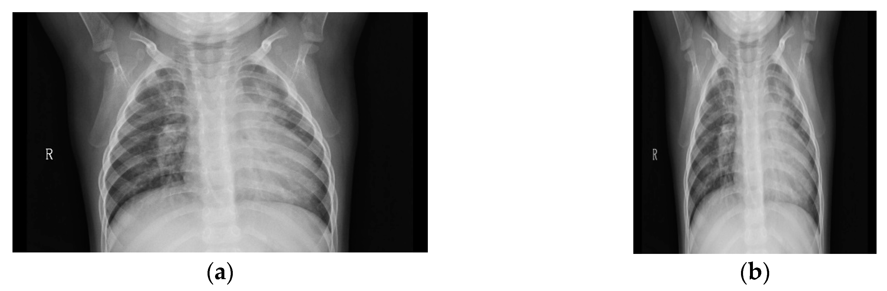 Applsci 10 02908 g006 Applsci 10 02908 g006