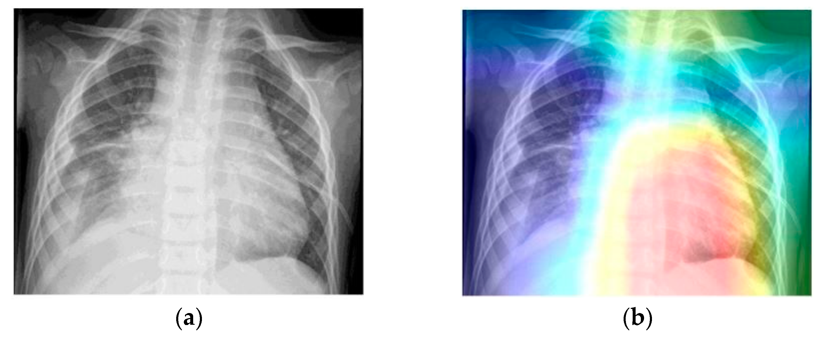 Applsci 10 02908 g013 Applsci 10 02908 g013