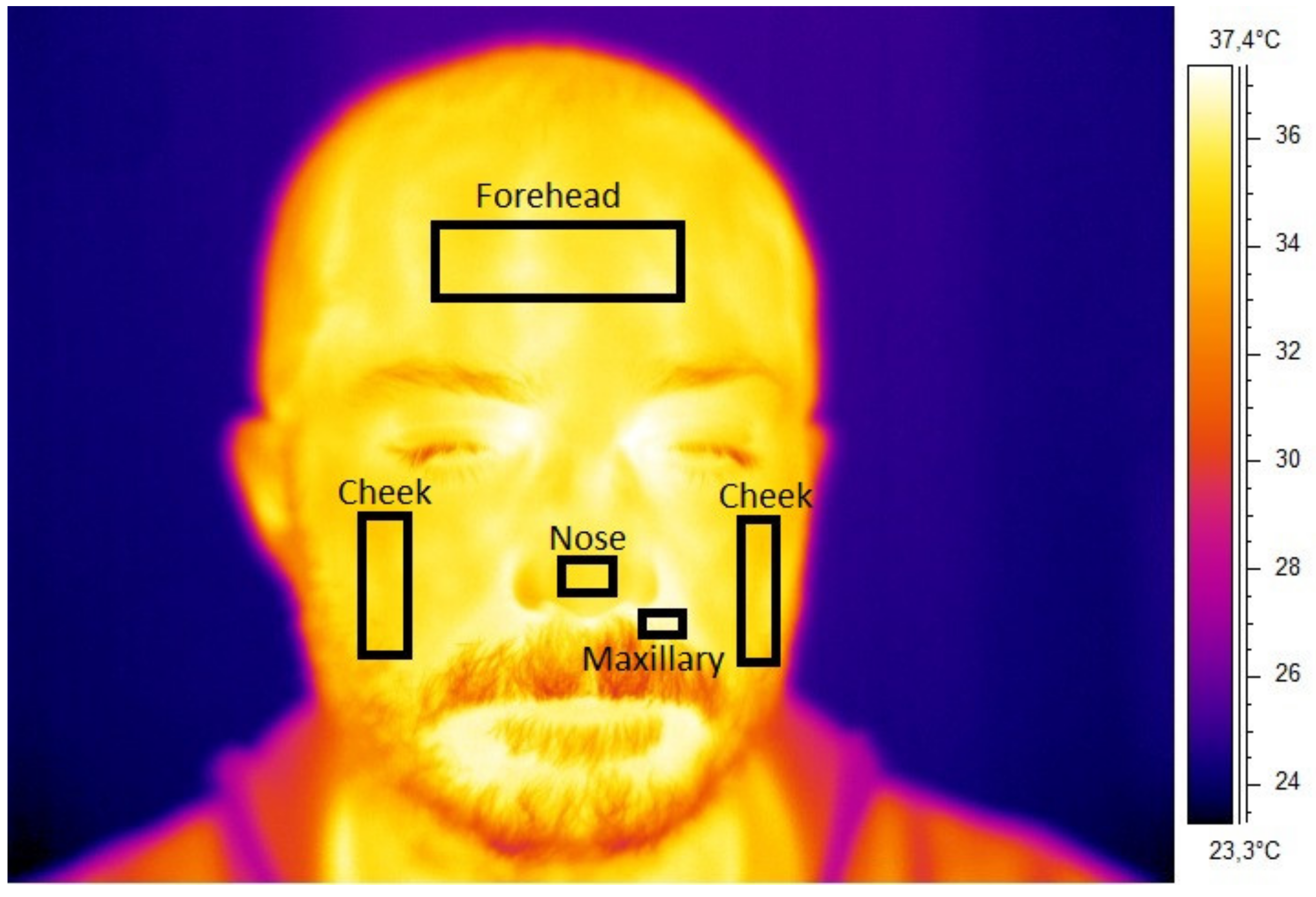 Applsci 10 02924 g002