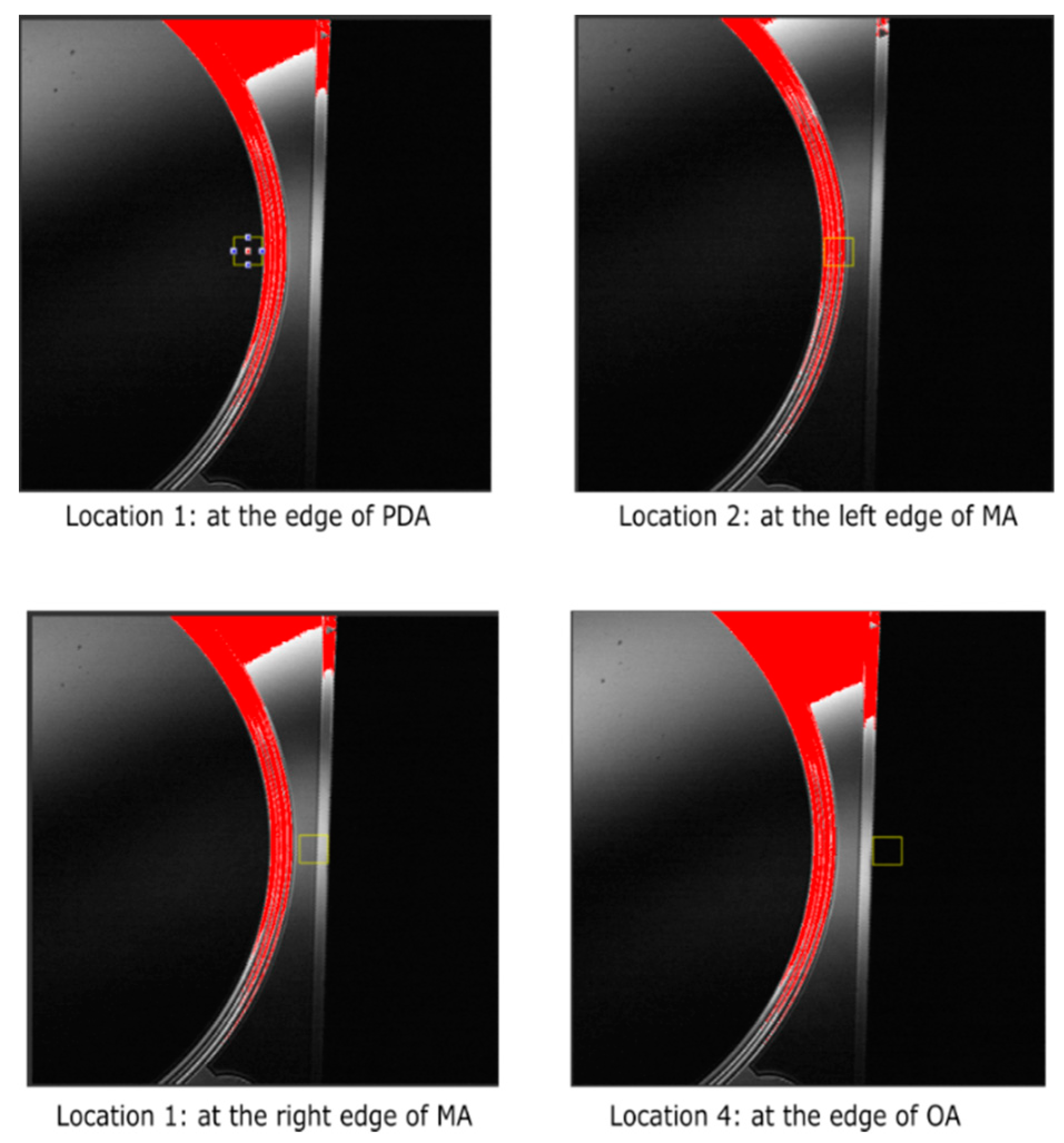 Applsci 10 03018 g004