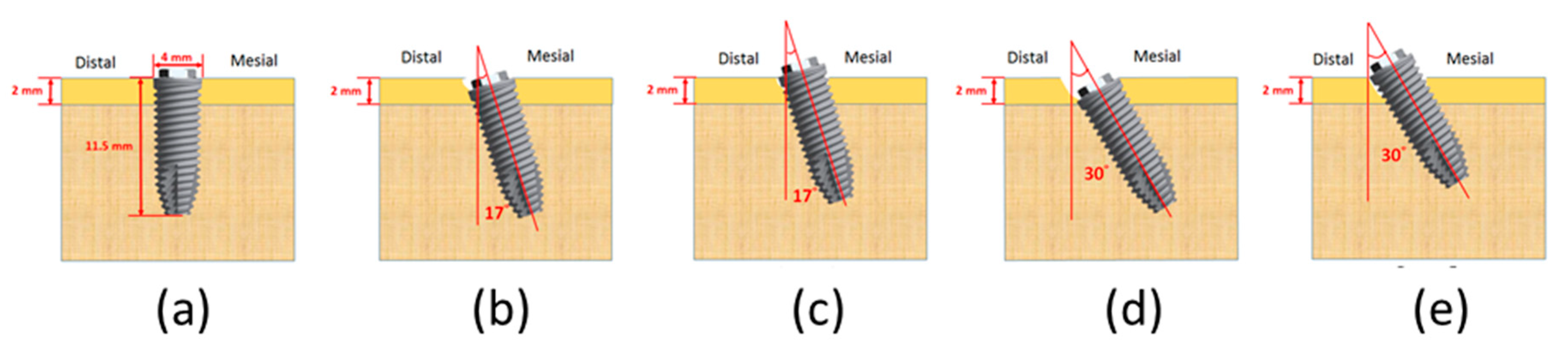 Applsci 10 03112 g002 Applsci 10 03112 g002