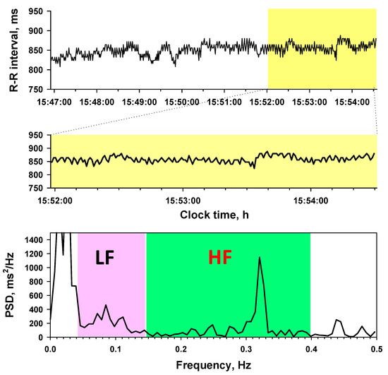 Applied Sciences Free FullText Impact of Heart Rate Fragmentation